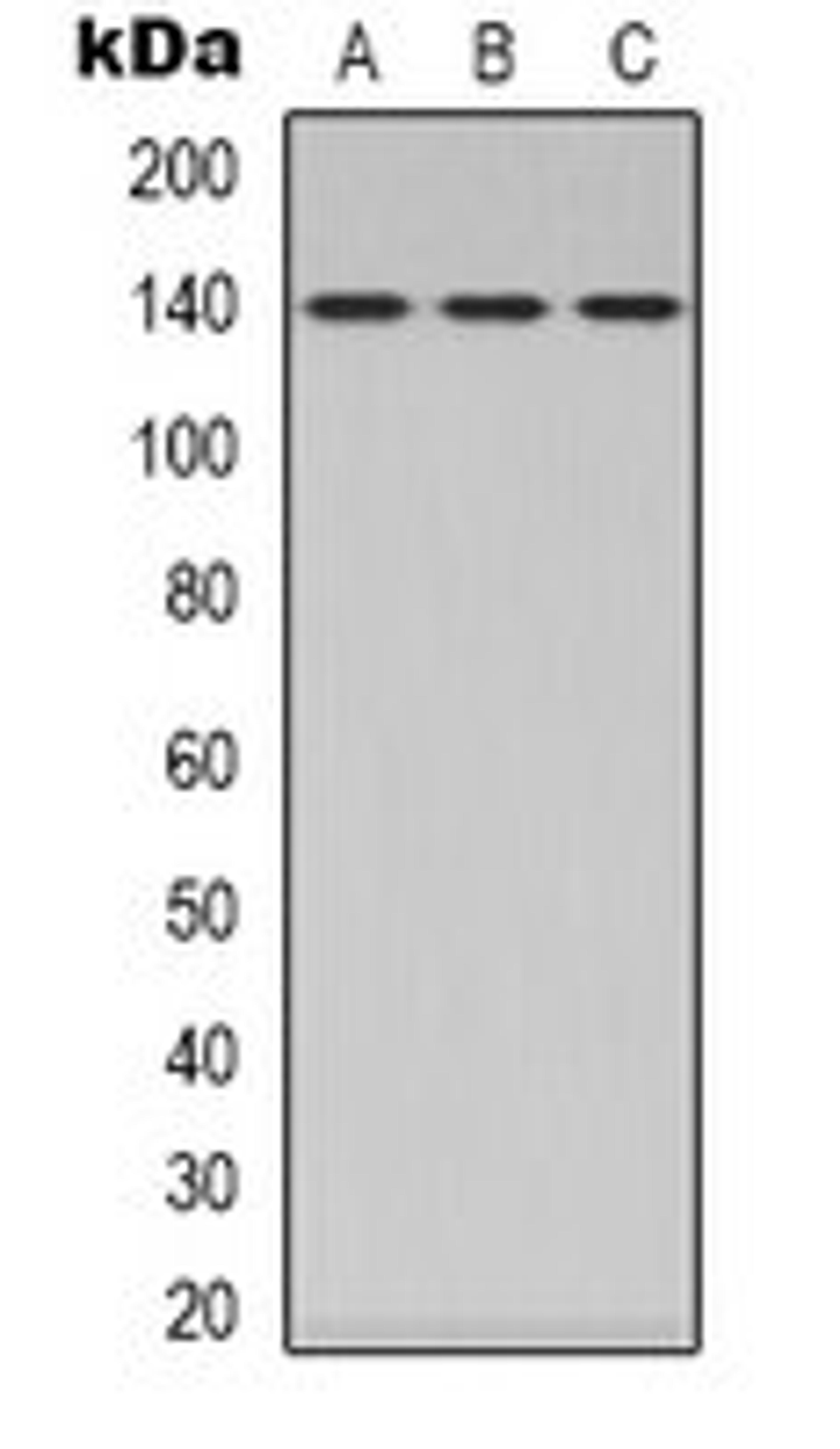 Western blot analysis of HEK293T (Lane 1), Hela (Lane 2), NIH3T3 (Lane 3) whole cell lysates using MYPT1 antibody