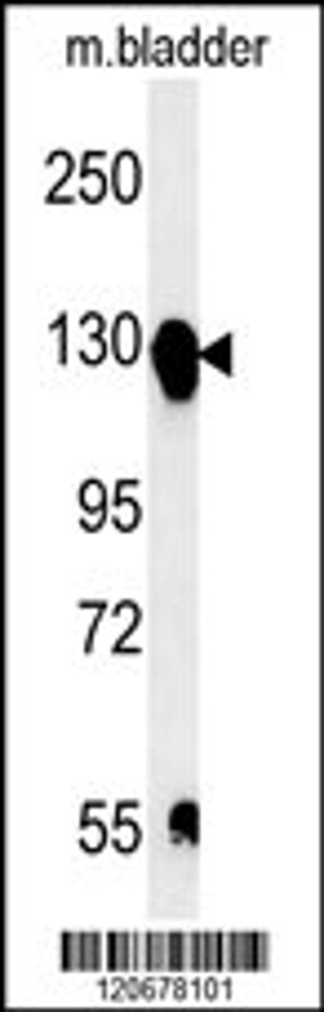 Western blot analysis in mouse bladder tissue lysates (15ug/lane).This demonstrates the detected ITGA5 protein (arrow).