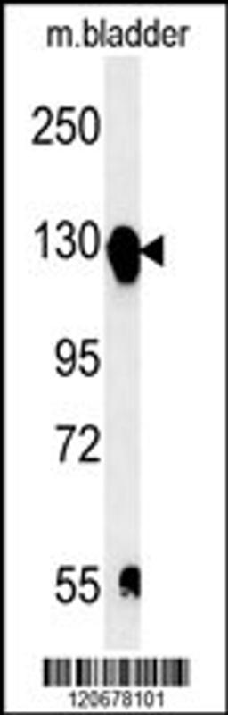 Western blot analysis in mouse bladder tissue lysates (15ug/lane).This demonstrates the detected ITGA5 protein (arrow).