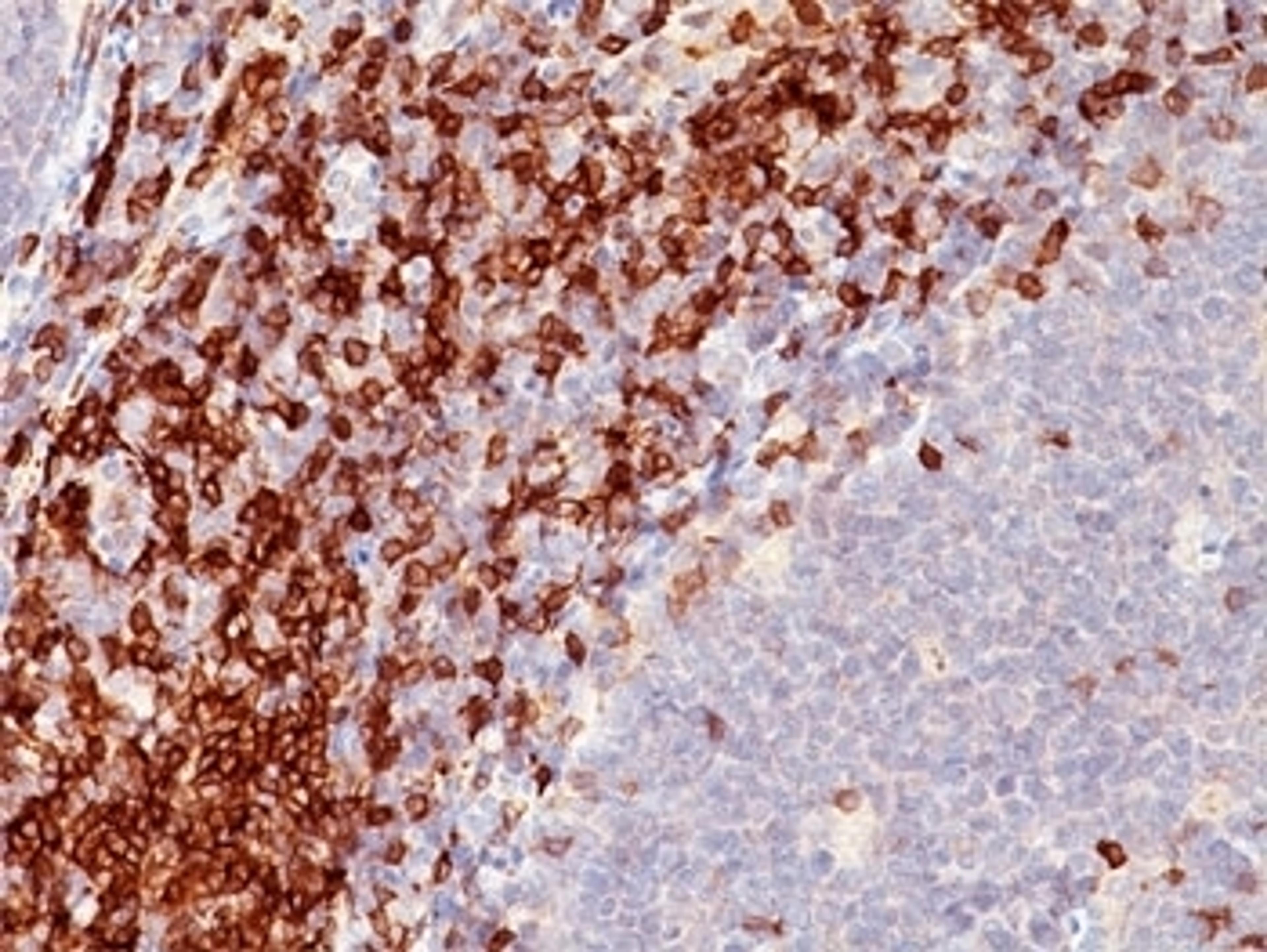 IHC testing of human tonsil stained with CD5 antibody (C5/473)