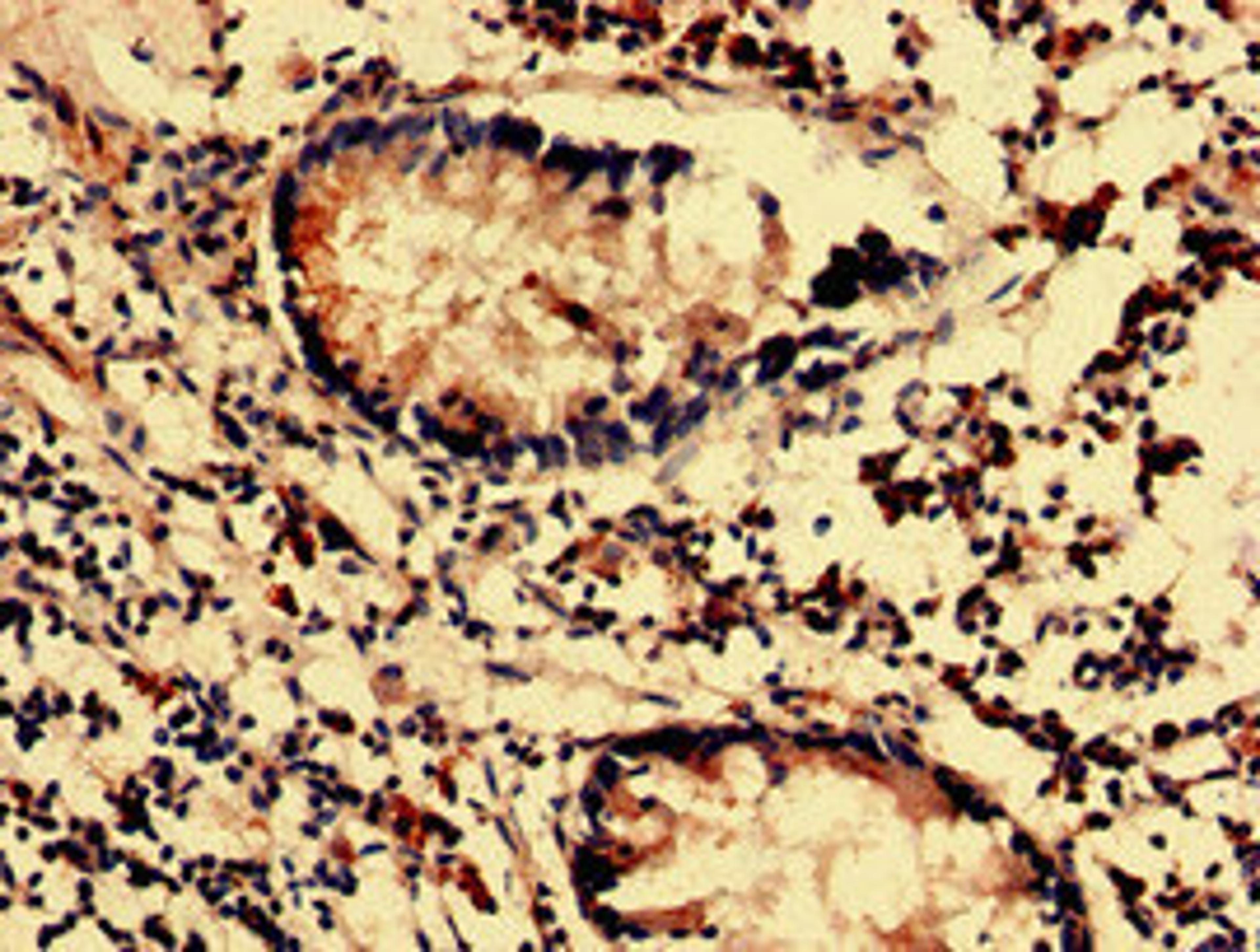 Immunohistochemistry analysis of human appendix tissue using CSB-PA878885LA01HU at dilution of 1:100