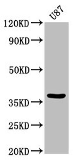 Western Blot. Positive WB detected in: U87 whole cell lysate. All lanes: GJD2 antibody at 3.2µg/ml. Secondary. Goat polyclonal to rabbit IgG at 1/50000 dilution. Predicted band size: 37 kDa. Observed band size: 37 kDa