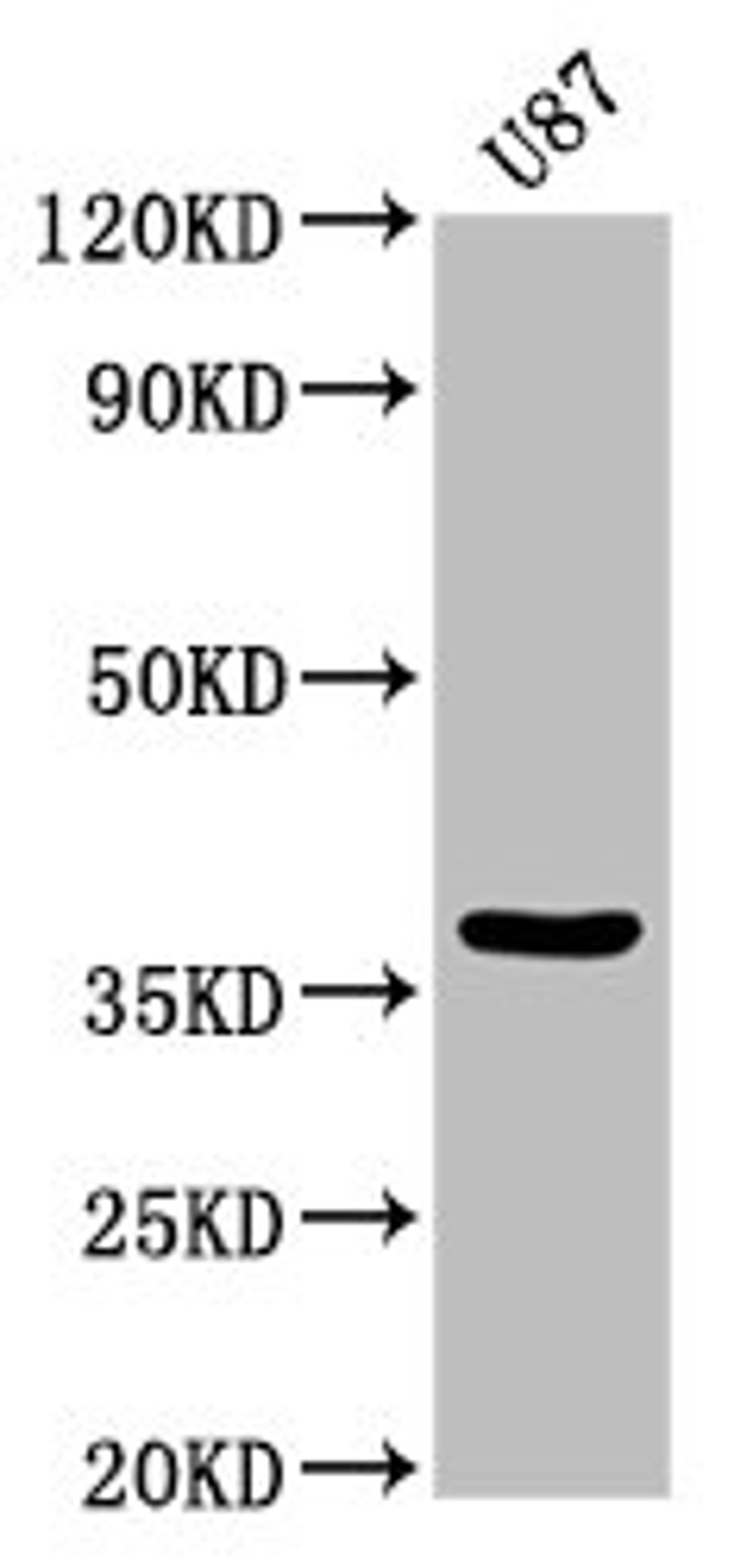 Western Blot. Positive WB detected in: U87 whole cell lysate. All lanes: GJD2 antibody at 3.2µg/ml. Secondary. Goat polyclonal to rabbit IgG at 1/50000 dilution. Predicted band size: 37 kDa. Observed band size: 37 kDa