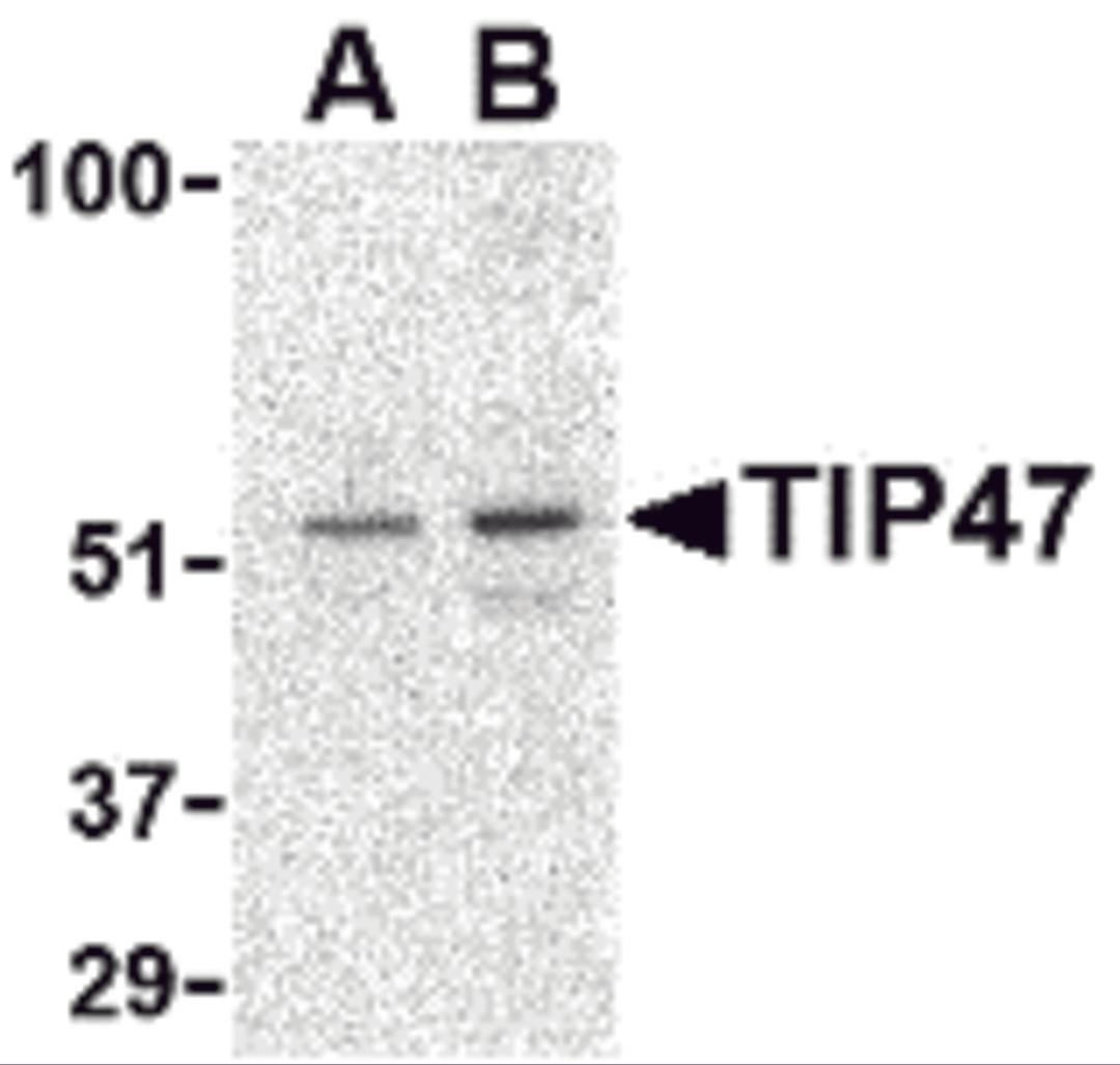 Western blot analysis of TIP47 in Daudi cell lysate with TIP47 antibody at (A) 0.5 and (B) 1 &#956;g/mL.