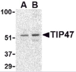 Western blot analysis of TIP47 in Daudi cell lysate with TIP47 antibody at (A) 0.5 and (B) 1 &#956;g/mL.