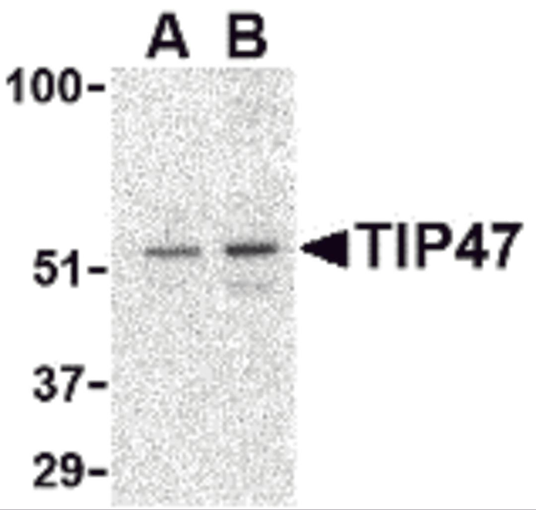 Western blot analysis of TIP47 in Daudi cell lysate with TIP47 antibody at (A) 0.5 and (B) 1 μg/mL.