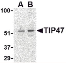 Western blot analysis of TIP47 in Daudi cell lysate with TIP47 antibody at (A) 0.5 and (B) 1 μg/mL.
