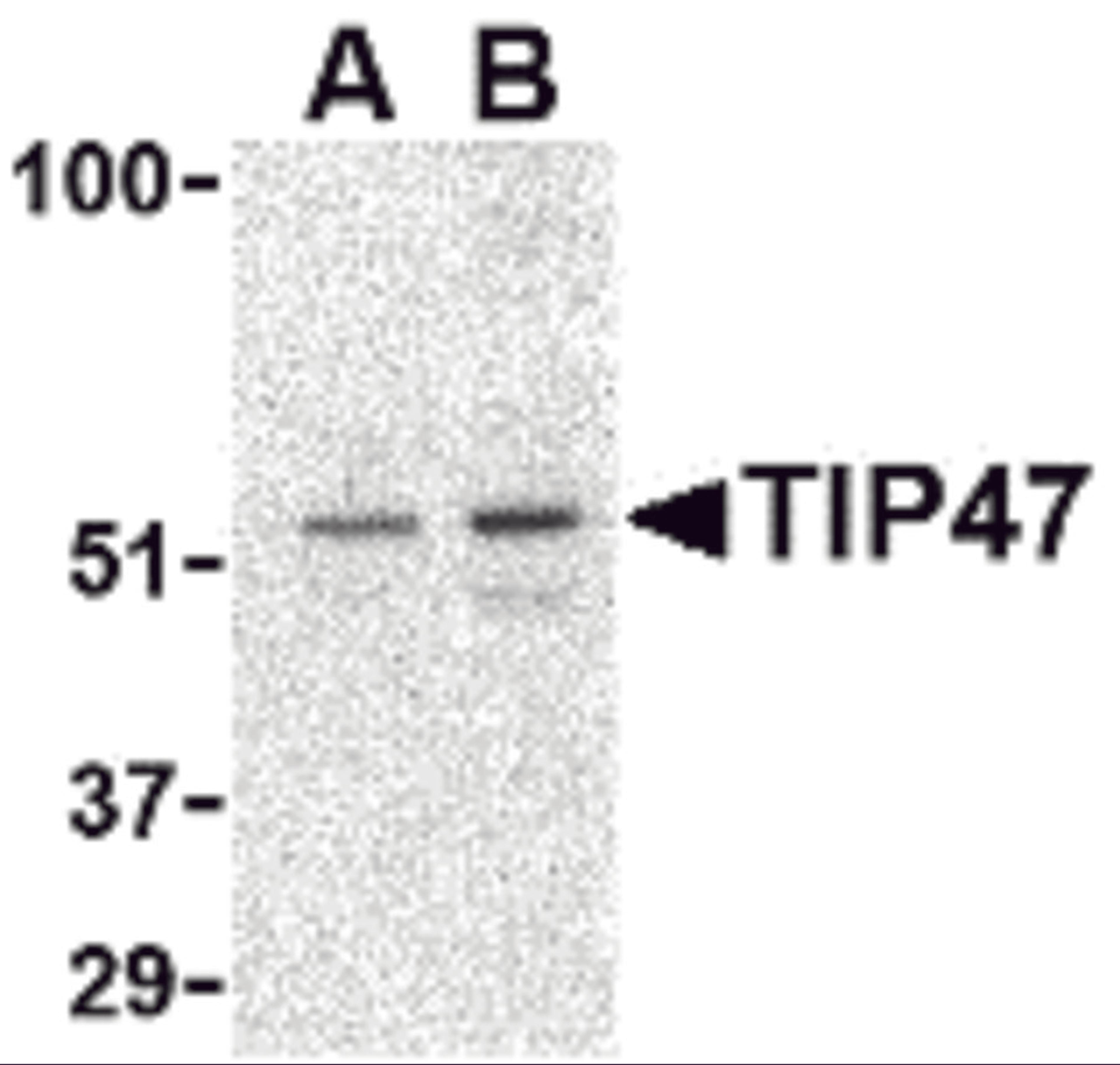 Western blot analysis of TIP47 in Daudi cell lysate with TIP47 antibody at (A) 0.5 and (B) 1 μg/mL.