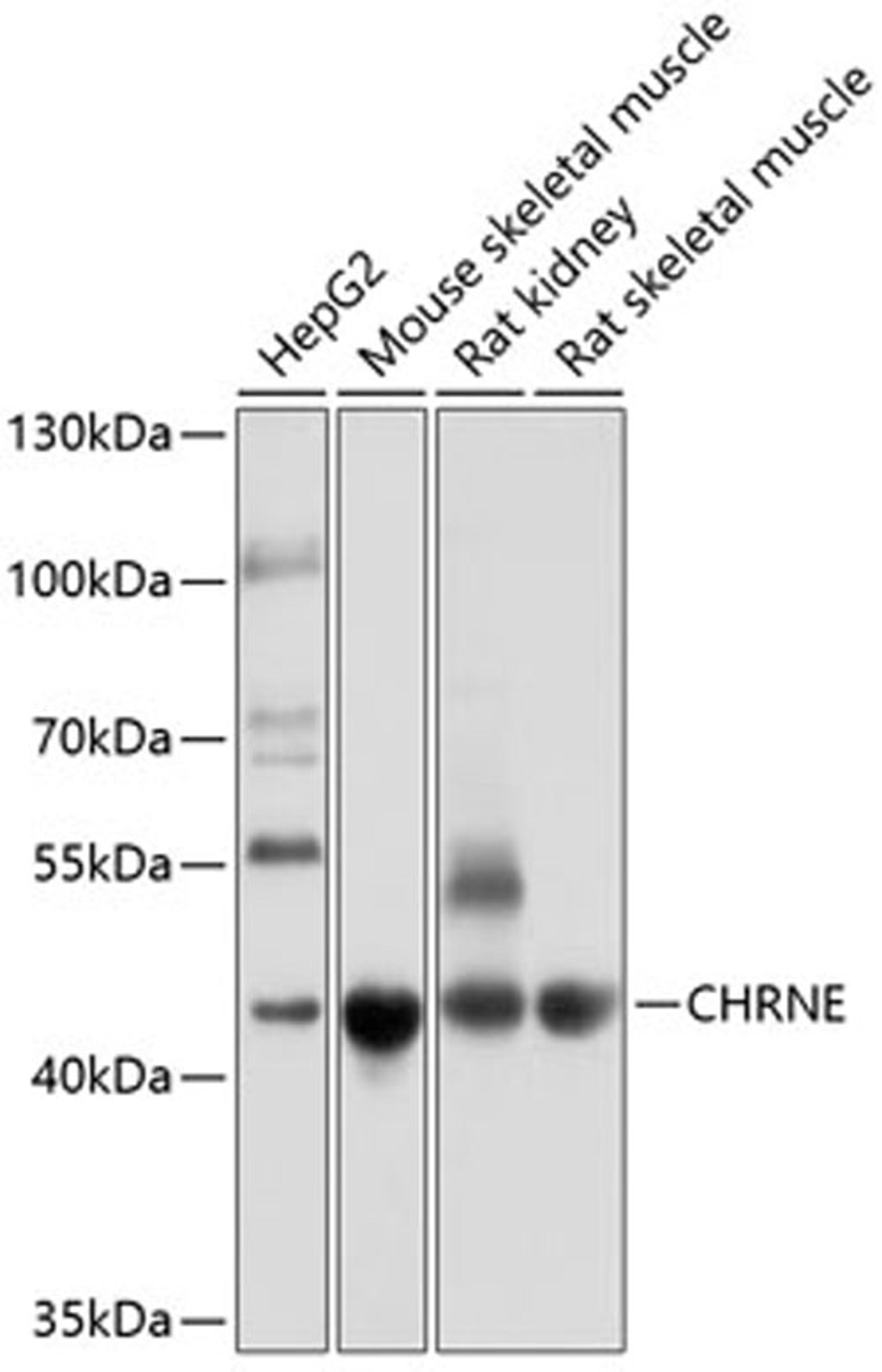 Western blot - CHRNE antibody (A10057)