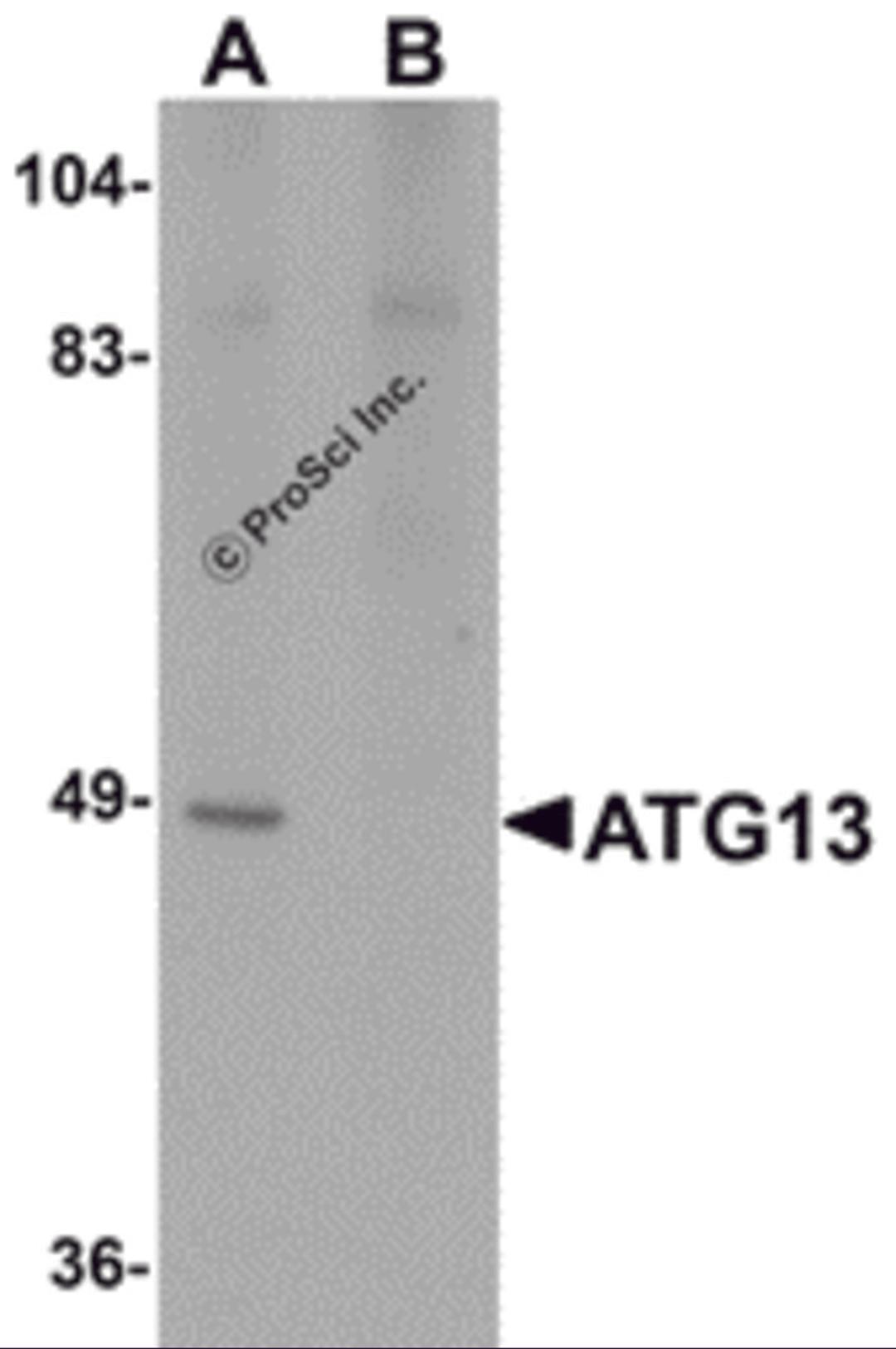 Western blot analysis of ATG13 in rat heart tissue lysate with ATG13 antibody at 1 μg/mL in (A) the absence and (B) the presence of blocking peptide.