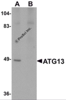 Western blot analysis of ATG13 in rat heart tissue lysate with ATG13 antibody at 1 μg/mL in (A) the absence and (B) the presence of blocking peptide.