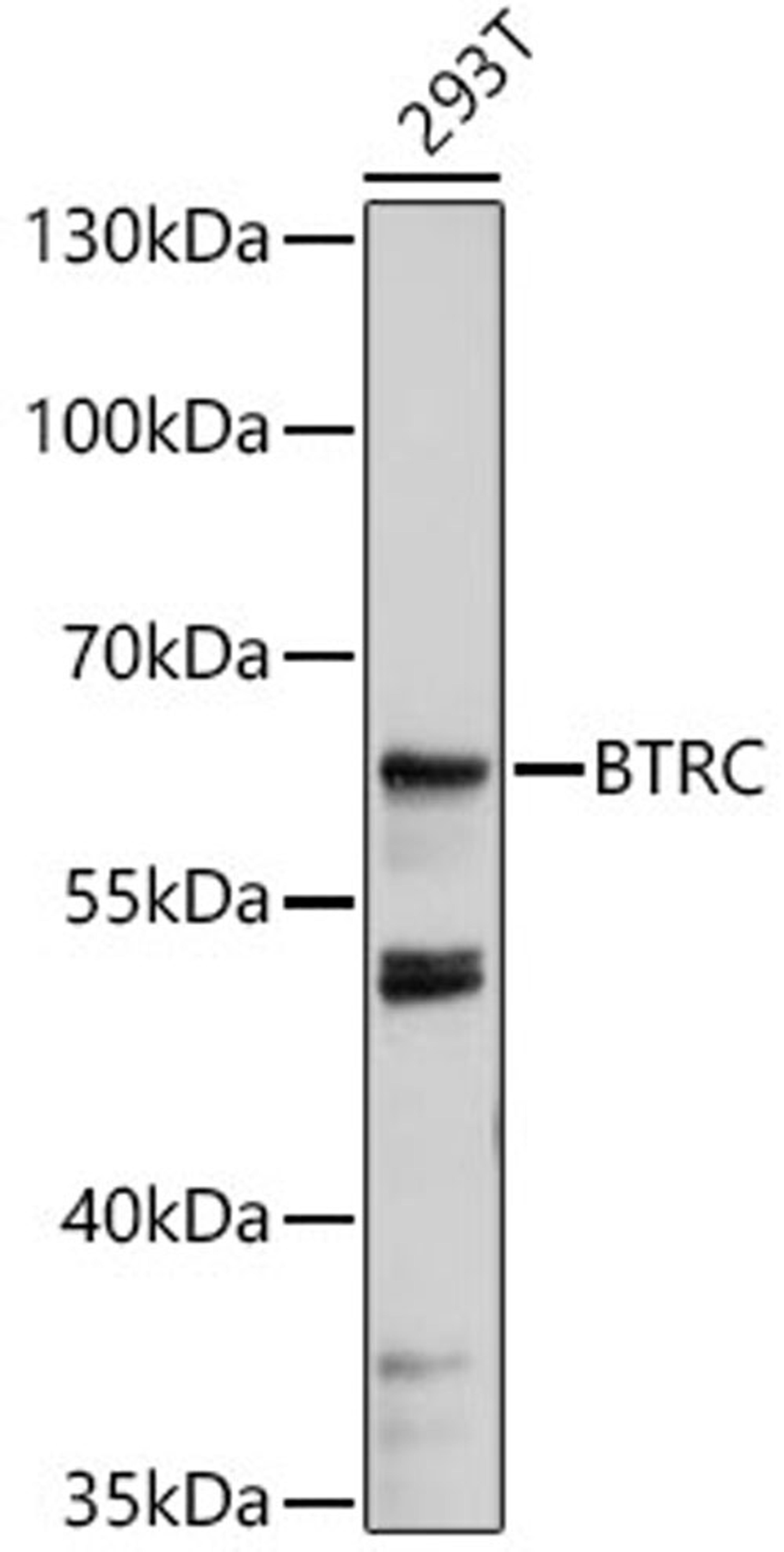 Western blot - BTRC antibody (A18232)