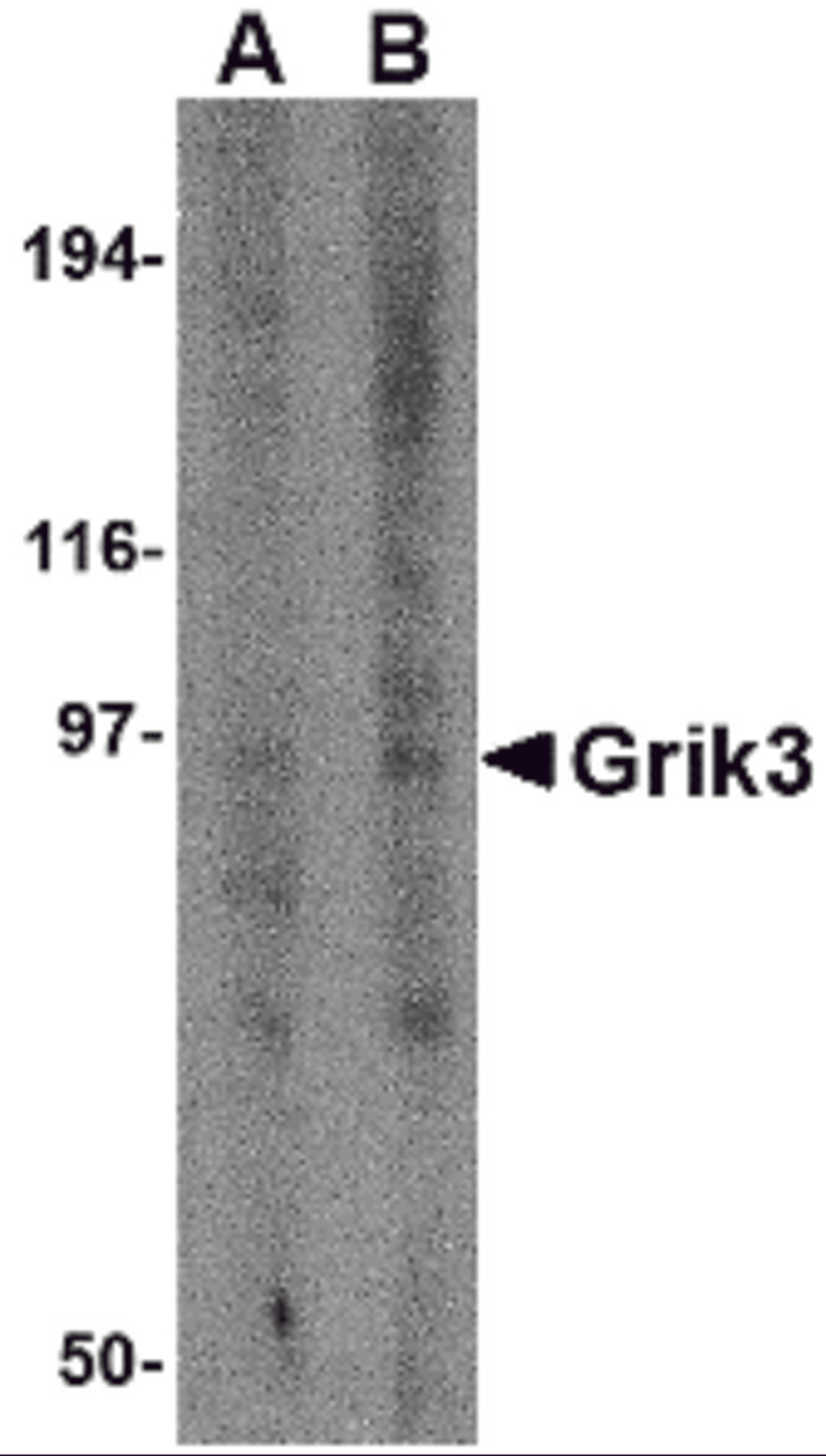 Western blot analysis of Grik3 in human brain tissue lysate with Grik3 antibody at (A) 1 and (B) 2 &#956;g/mL.