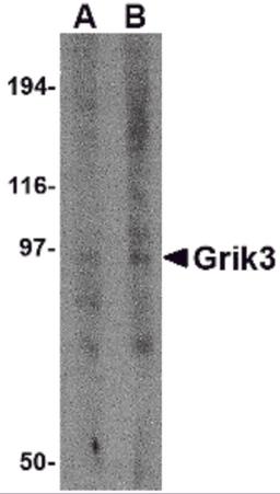 Western blot analysis of Grik3 in human brain tissue lysate with Grik3 antibody at (A) 1 and (B) 2 μg/mL.