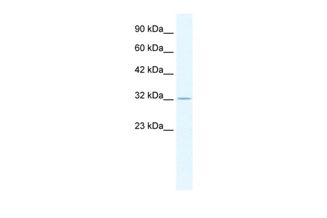 Antibody used in WB on Human HepG2 at 0.2-1 ug/ml.