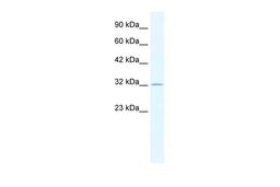 Antibody used in WB on Human HepG2 at 0.2-1 ug/ml.