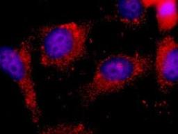 Detection of human ILK by immunocytochemistry.