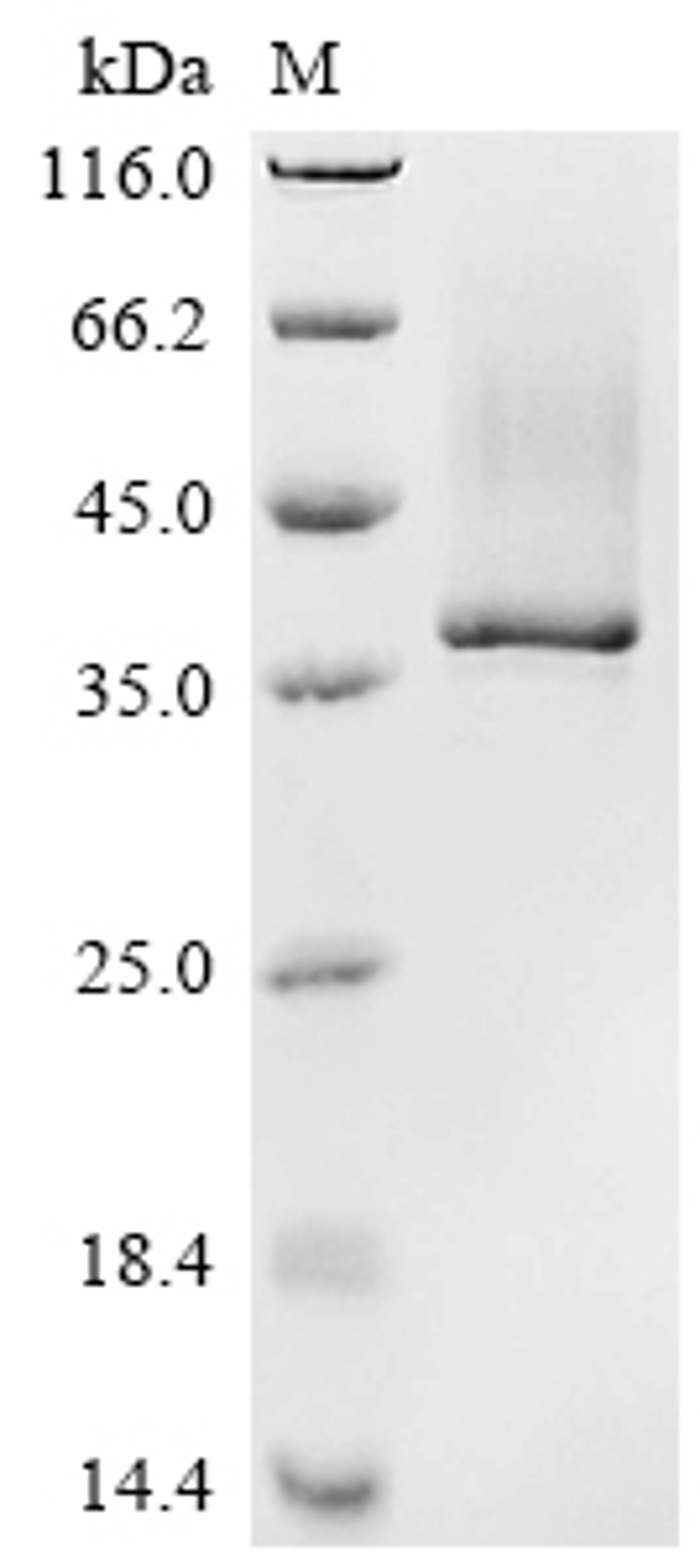 (Tris-Glycine gel) Discontinuous SDS-PAGE (reduced) with 5% enrichment gel and 15% separation gel.