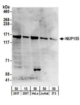 Detection of human and mouse NUP155 by western blot.