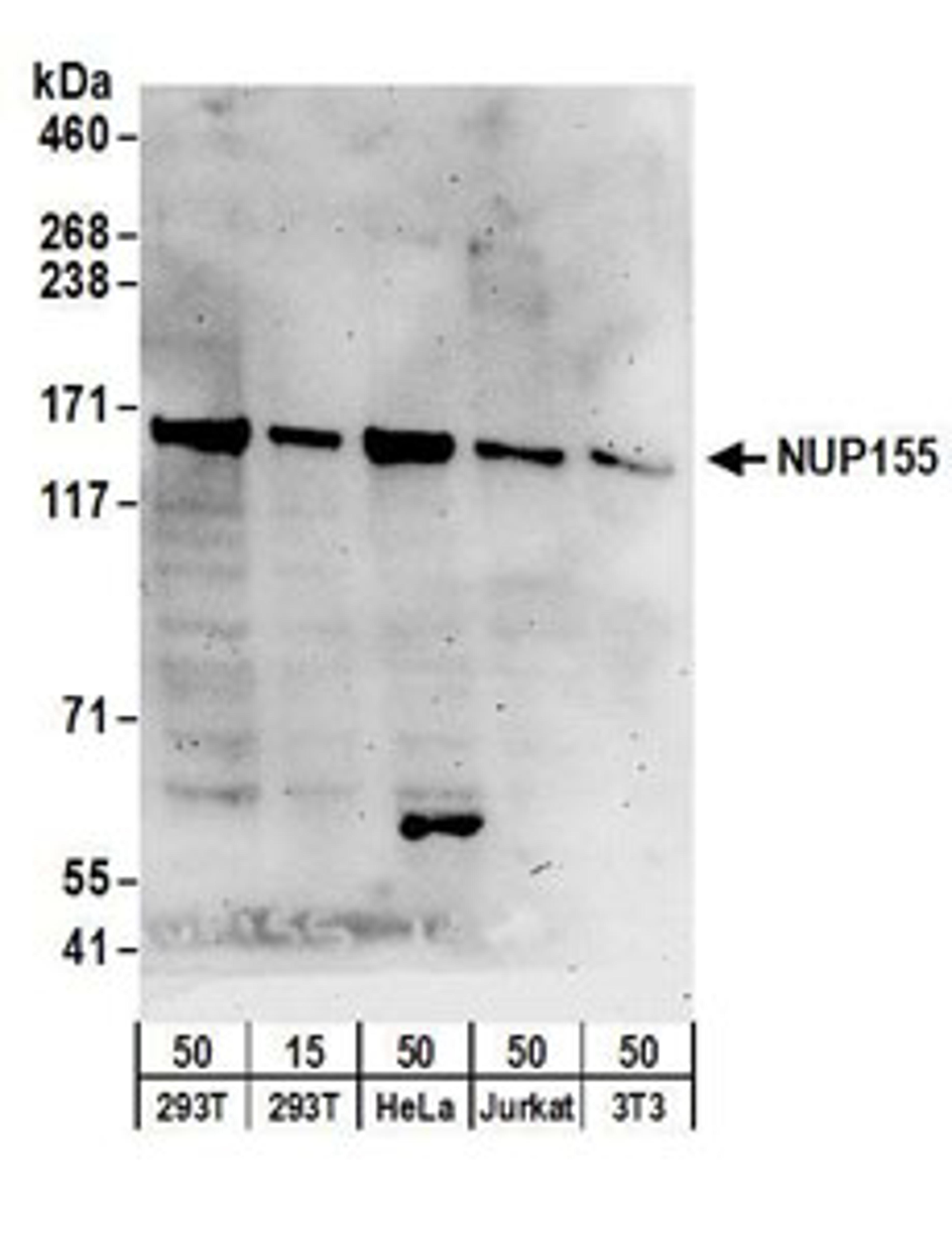 Detection of human and mouse NUP155 by western blot.