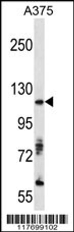 Western blot analysis of anti-AXL Antibody in A375 cell line lysates (35ug/lane)