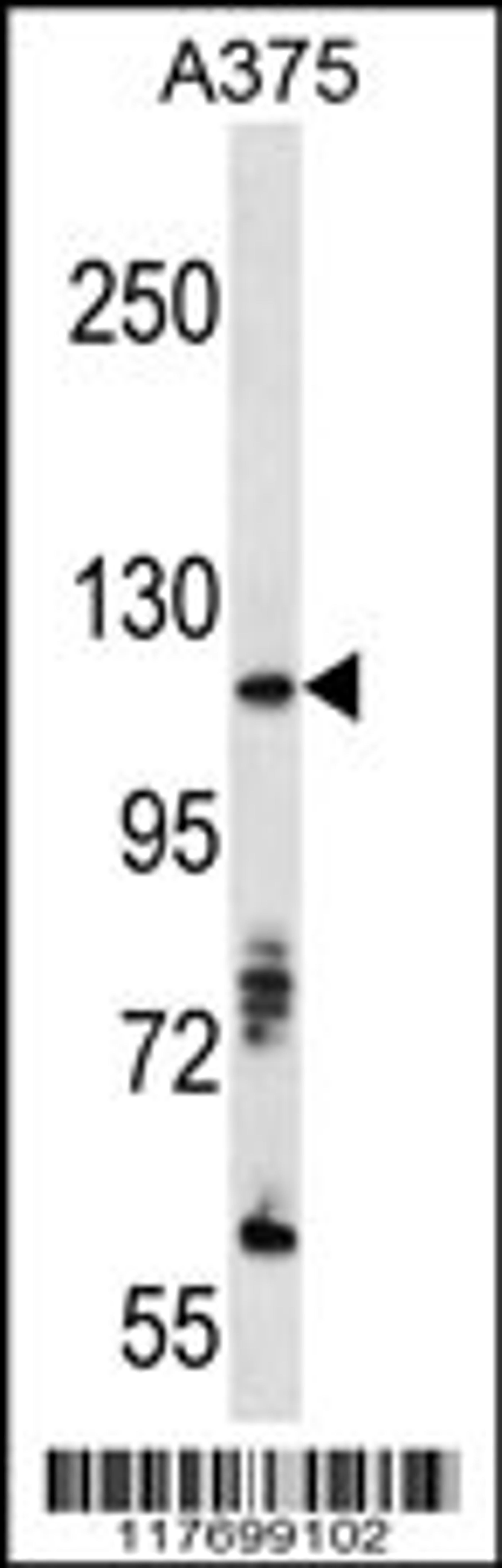 Western blot analysis of anti-AXL Antibody in A375 cell line lysates (35ug/lane)