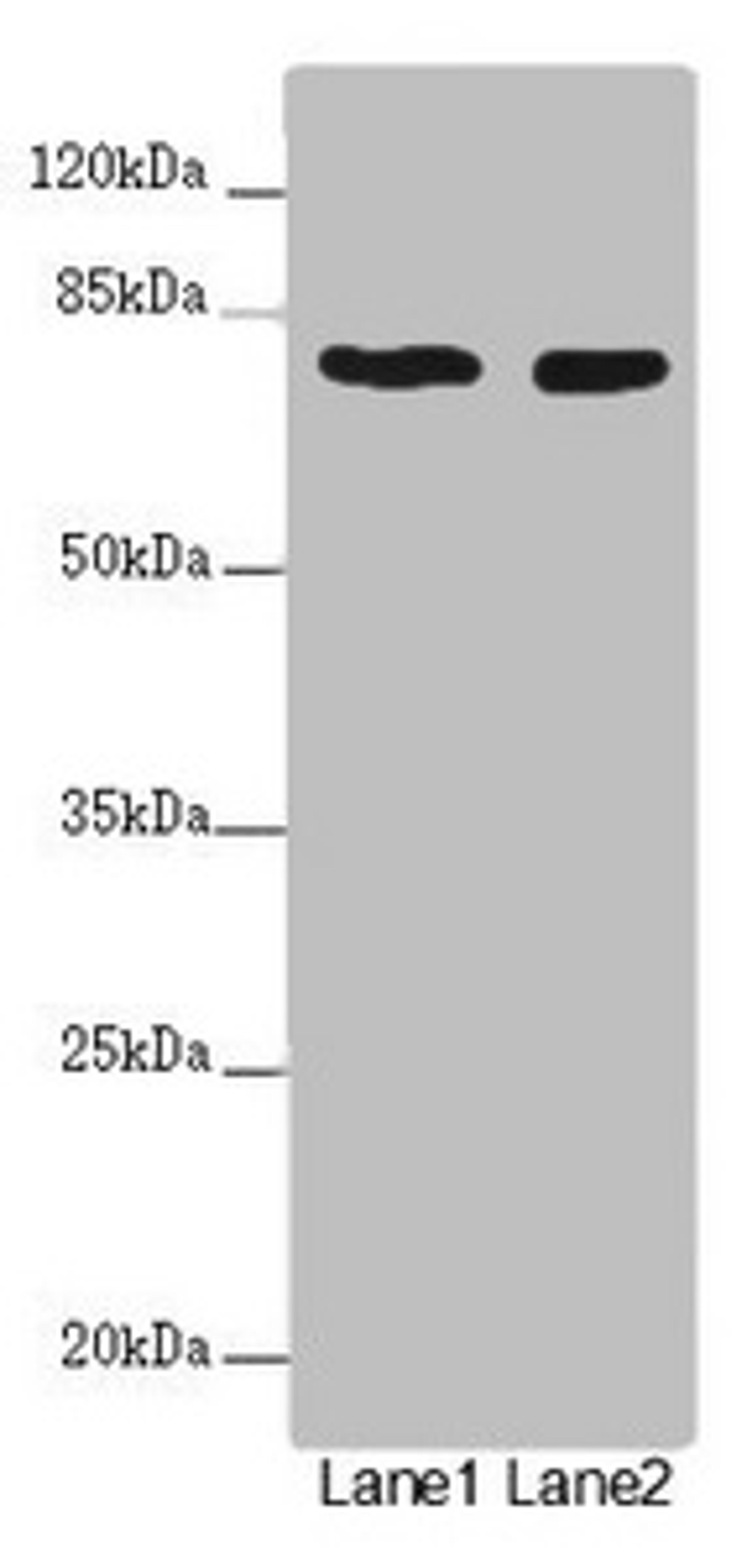 Western blot. All lanes: UVRAG antibody at 2µg/ml. Lane 1: SH-SY5Y whole cell lysate. Lane 2: 293T whole cell lysate. Secondary. Goat polyclonal to rabbit IgG at 1/10000 dilution. Predicted band size: 79, 36 kDa. Observed band size: 79 kDa