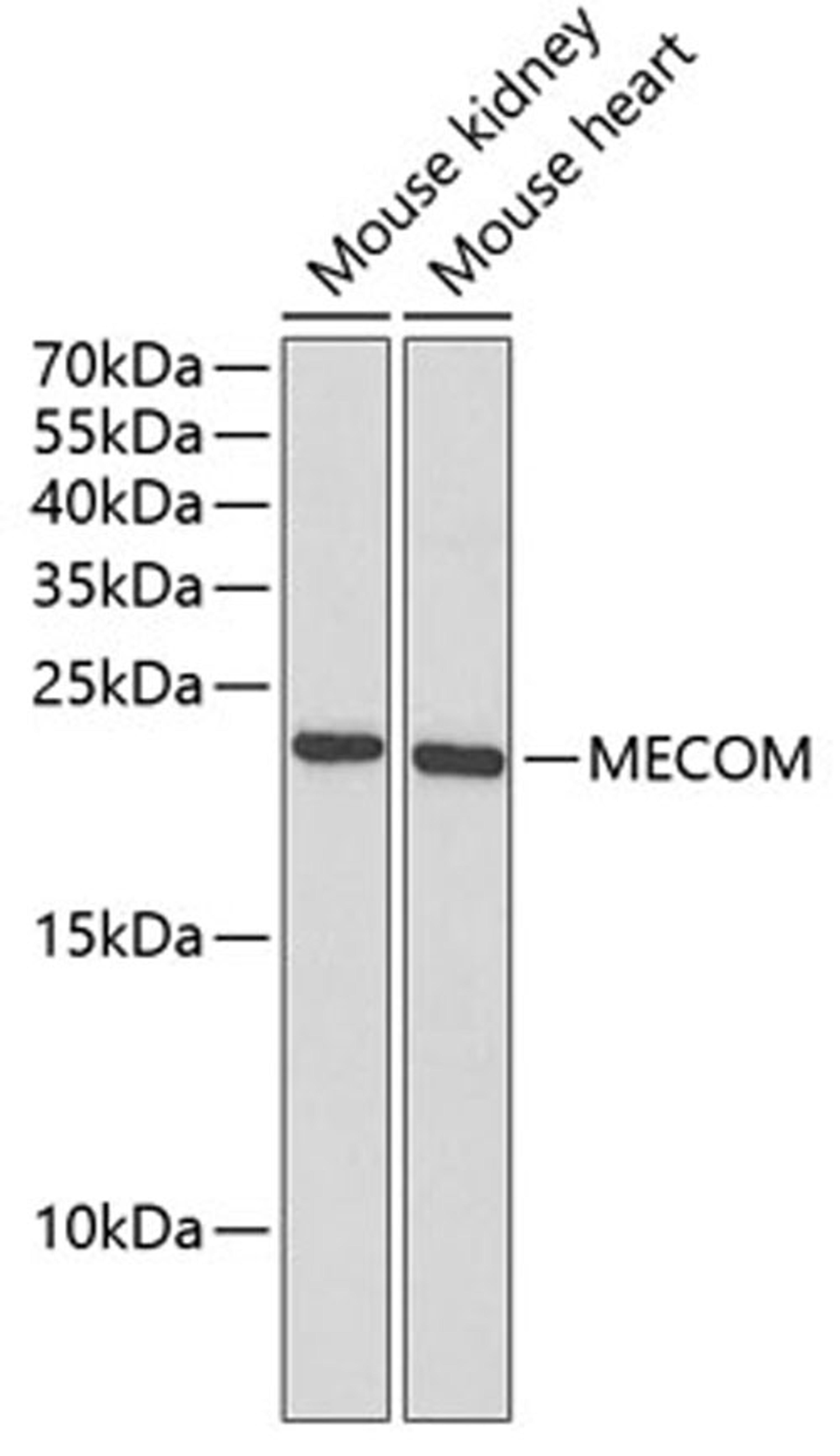 Western blot - MECOM antibody (A5674)