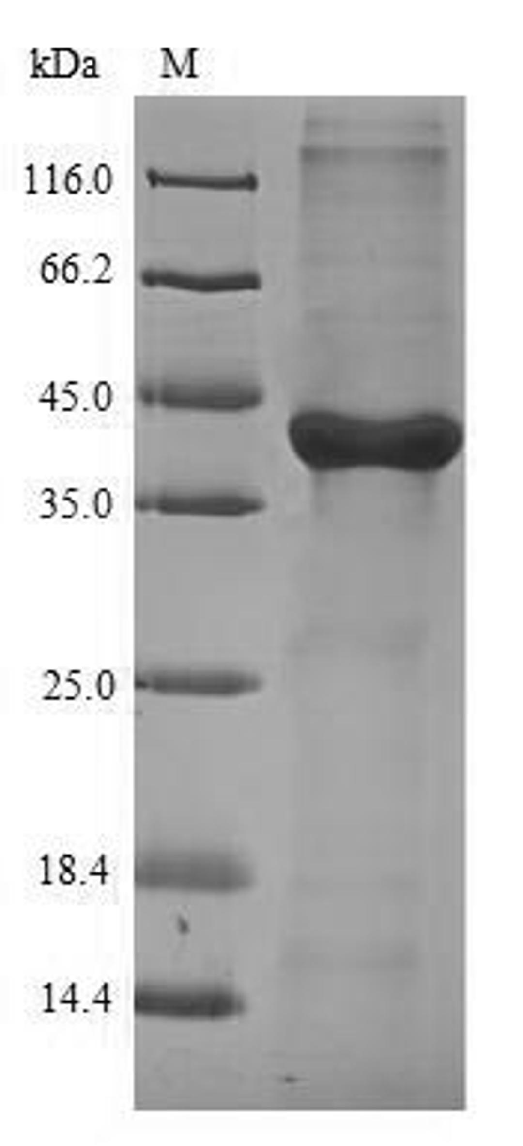 (Tris-Glycine gel) Discontinuous SDS-PAGE (reduced) with 5% enrichment gel and 15% separation gel.