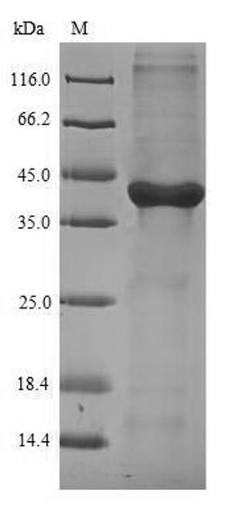 (Tris-Glycine gel) Discontinuous SDS-PAGE (reduced) with 5% enrichment gel and 15% separation gel.