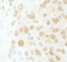 Detection of human CDC5L by immunohistochemistry.