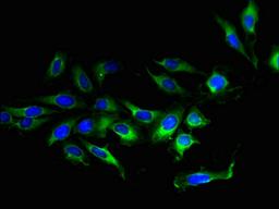Immunofluorescent analysis of Hela cells using CSB-PA023801LA01HU at dilution of 1:100 and Alexa Fluor 488-congugated AffiniPure Goat Anti-Rabbit IgG(H+L)