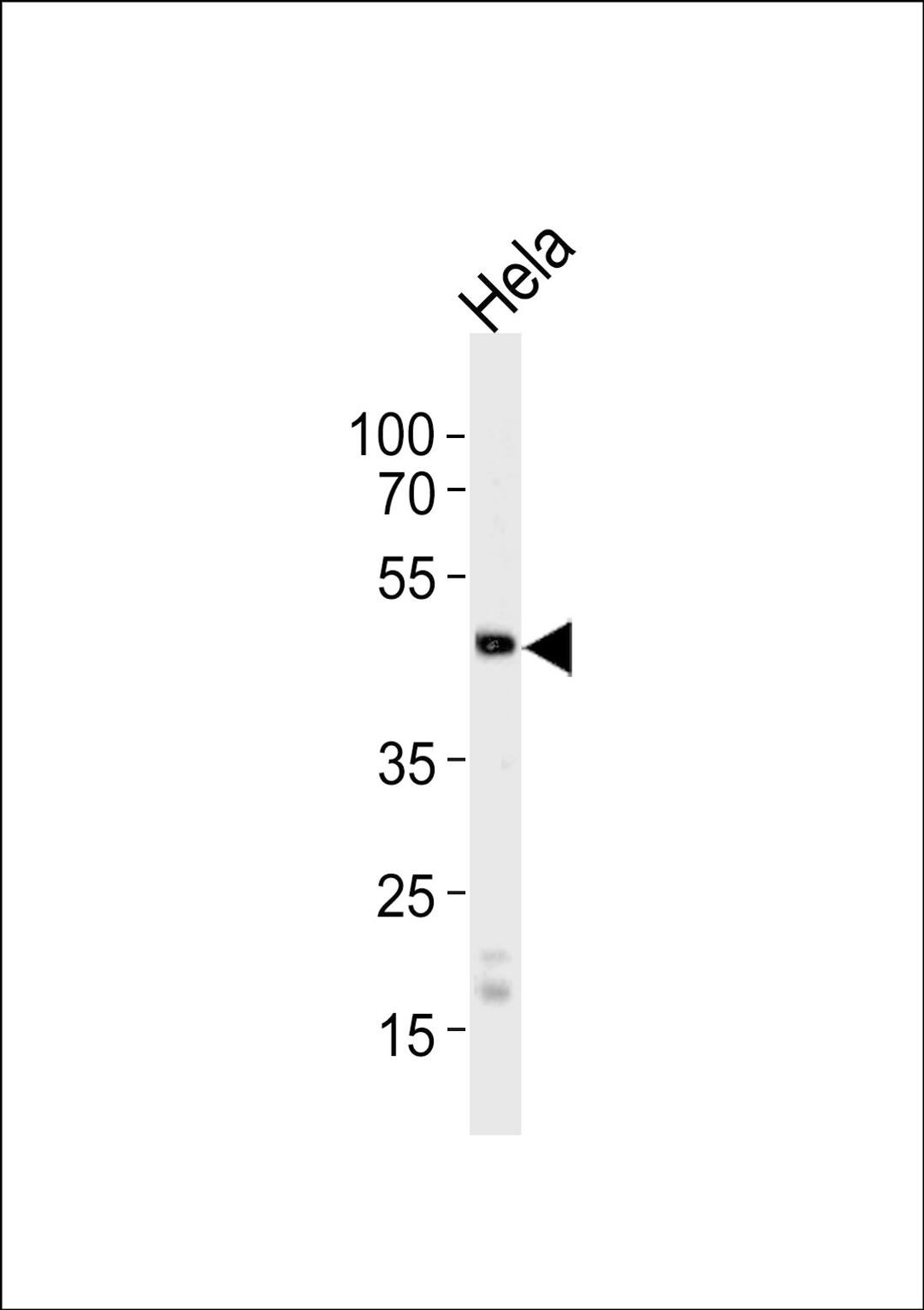 Western blot analysis of lysate from HeLa cell line, using WSB2 Antibody at 1:1000 at each lane.