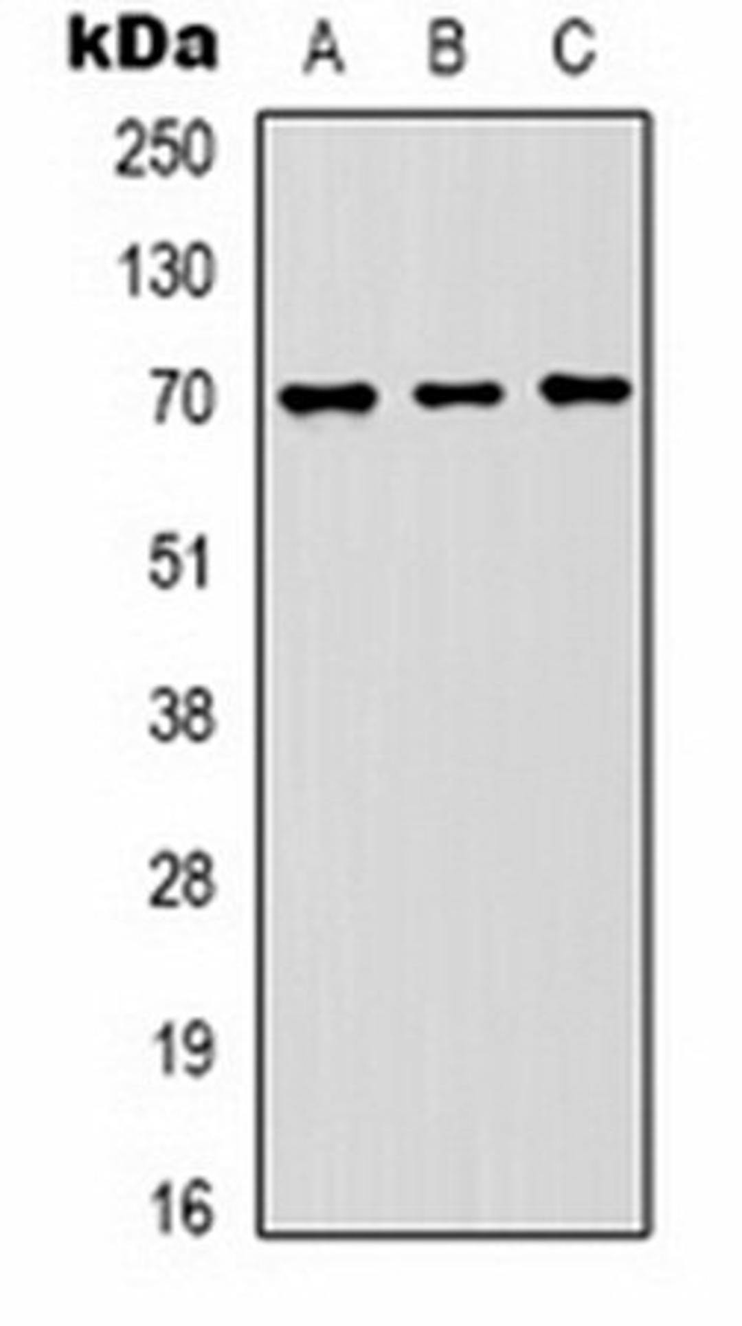 Western blot analysis of Hela (Lane 1), mouse brain (Lane 2), rat brain (Lane 3) whole cell lysates using HSC70 antibody