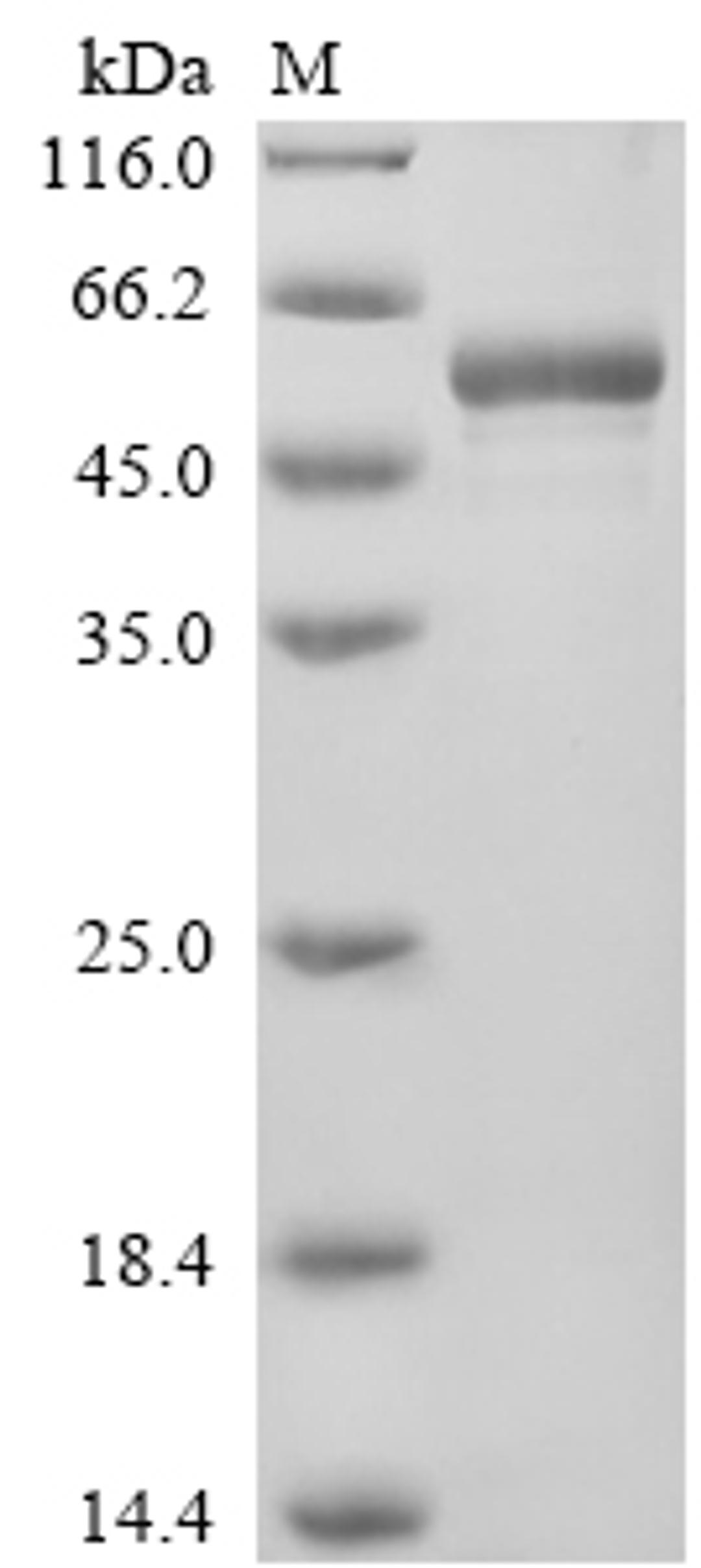 (Tris-Glycine gel) Discontinuous SDS-PAGE (reduced) with 5% enrichment gel and 15% separation gel.
