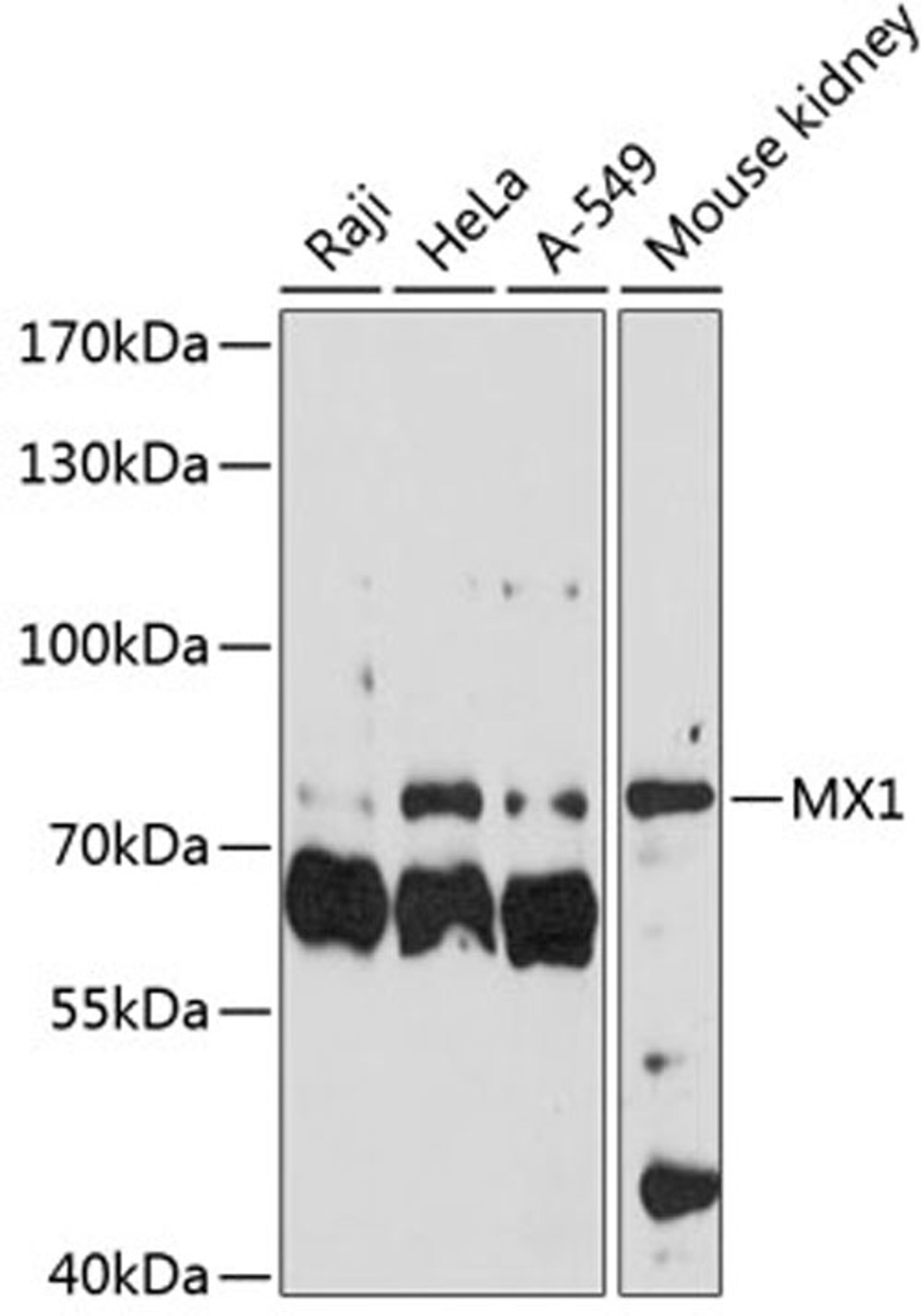 Western blot - MX1 antibody (A1780)