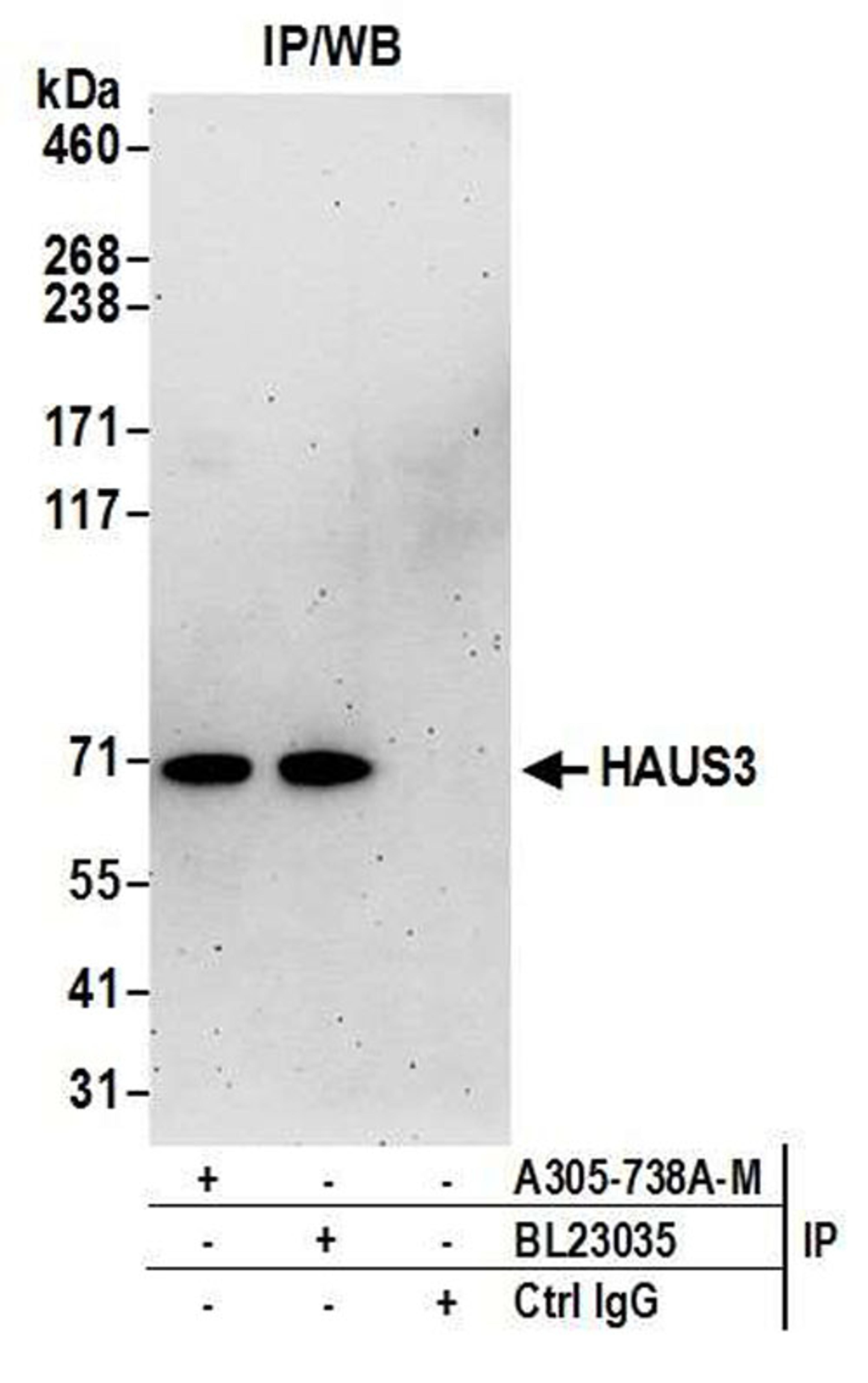 Detection of human HAUS3 by WB of IP.