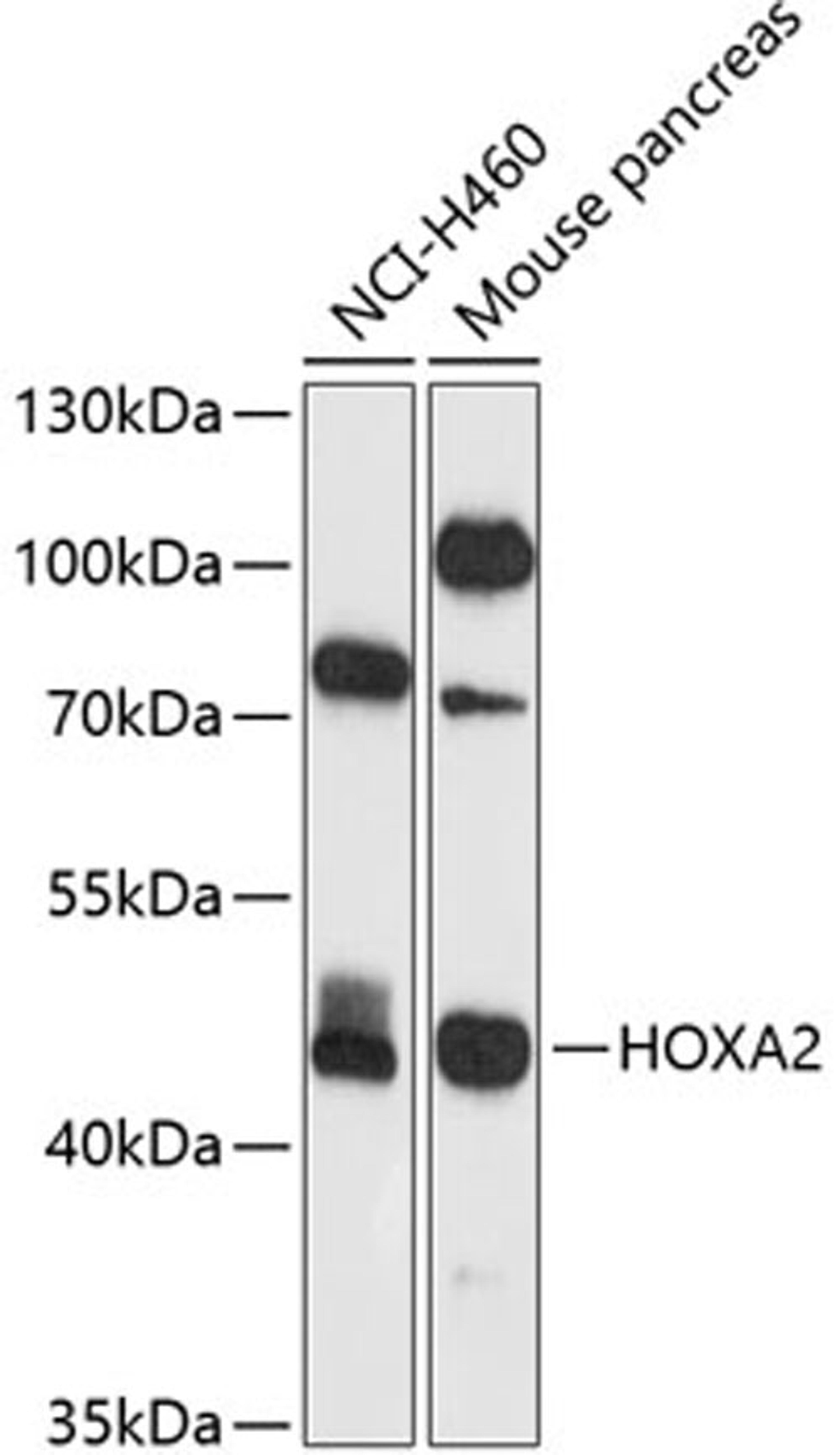 Western blot - HOXA2 antibody (A9658)