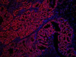 Detection of human SET by immunohistochemistry.