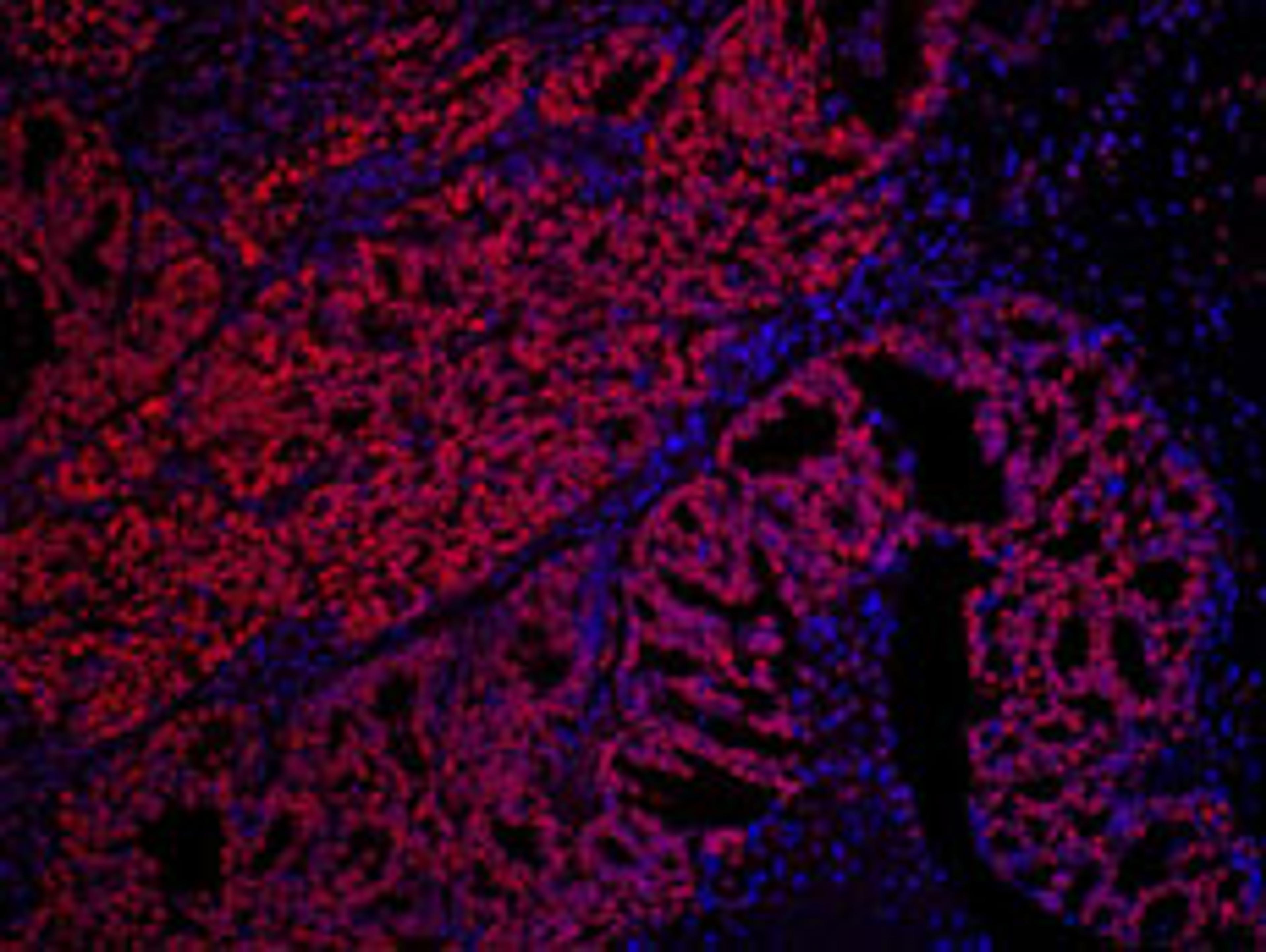 Detection of human SET by immunohistochemistry.