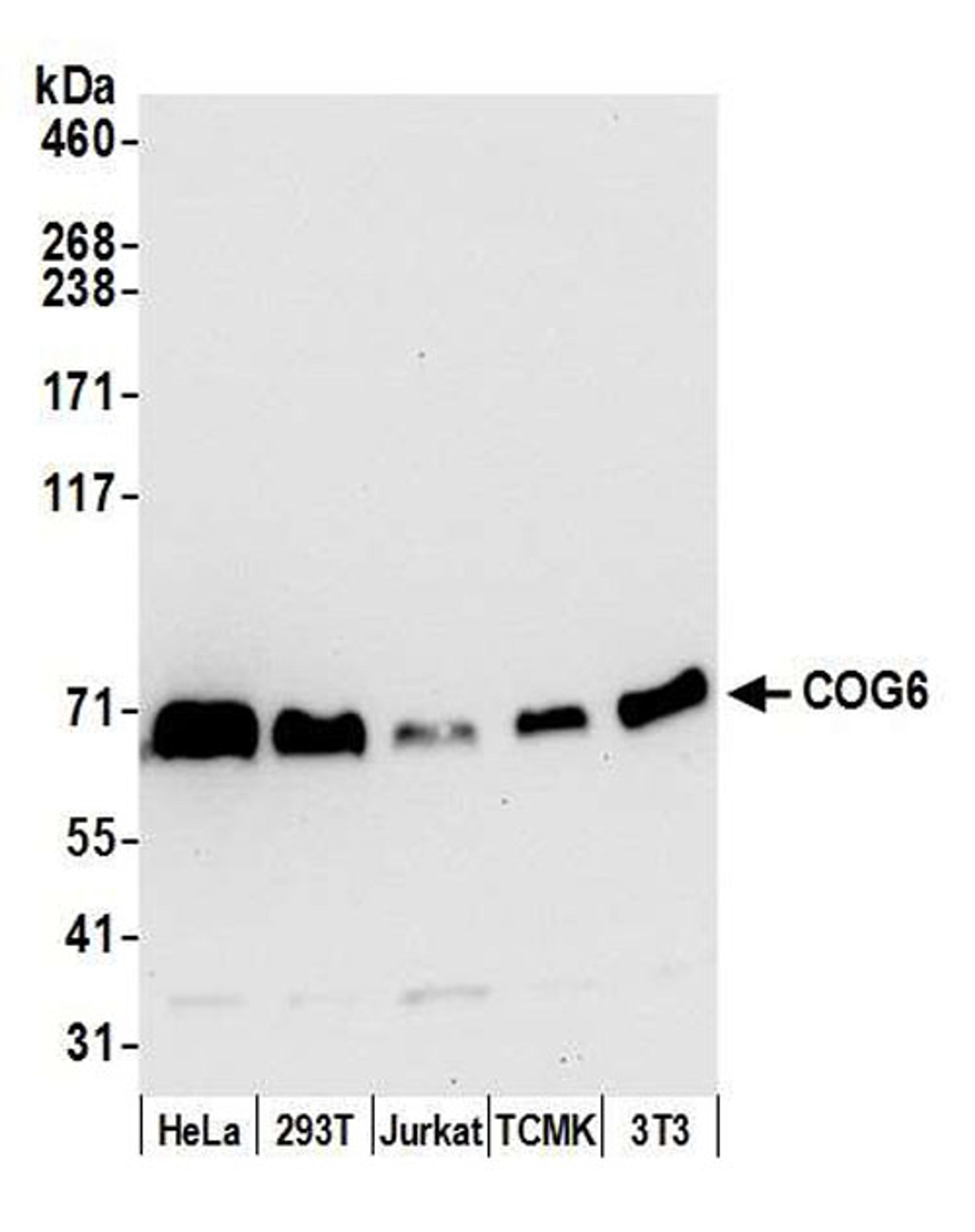 Detection of human and mouse COG6 by WB.