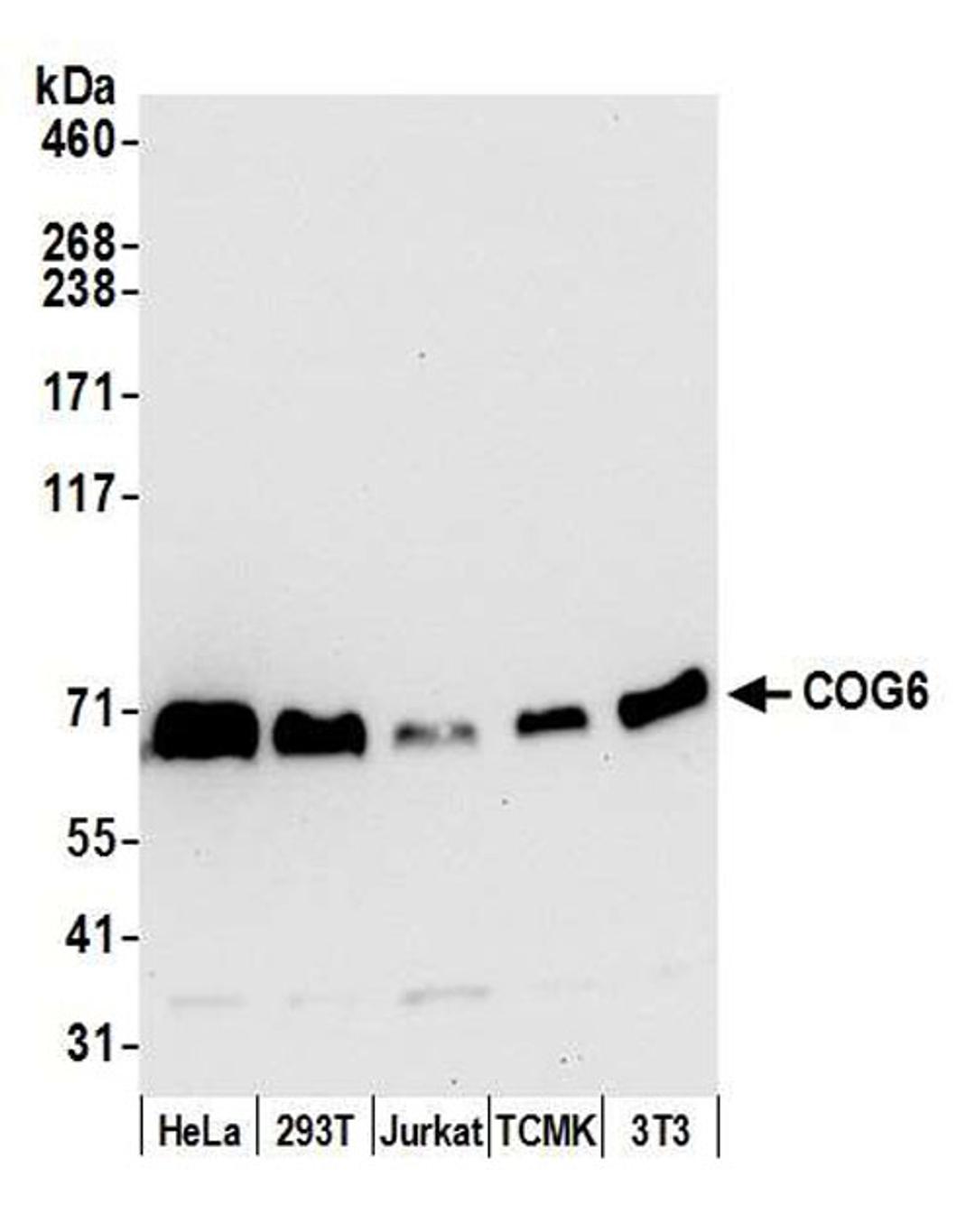 Detection of human and mouse COG6 by WB.