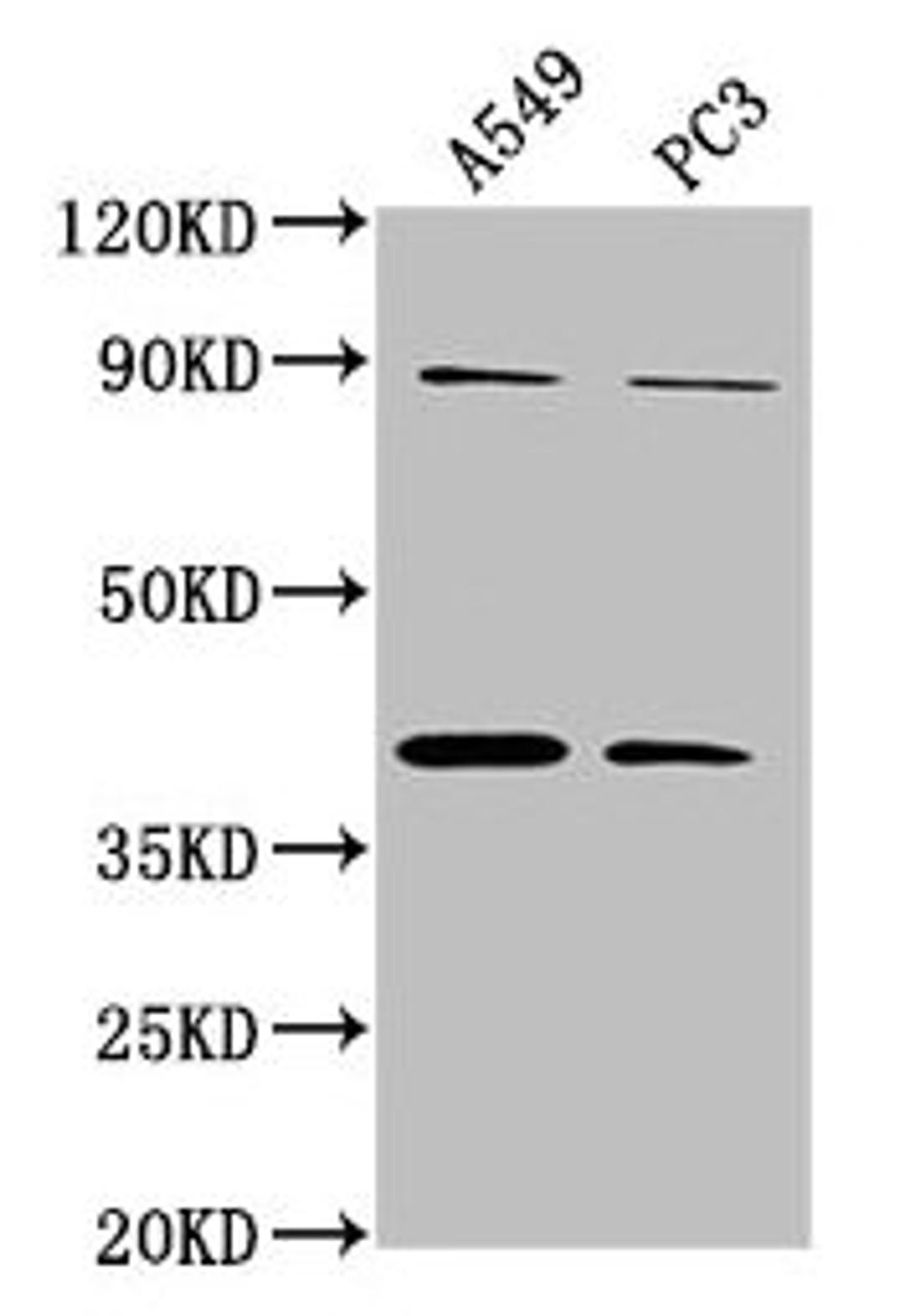 Western Blot. Positive WB detected in: A549 whole cell lysate, PC3 whole cell lysate. All lanes: ATP6V0D2 antibody at 1:2000. Secondary. Goat polyclonal to rabbit IgG at 1/50000 dilution. Predicted band size: 41 kDa. Observed band size: 41 kDa