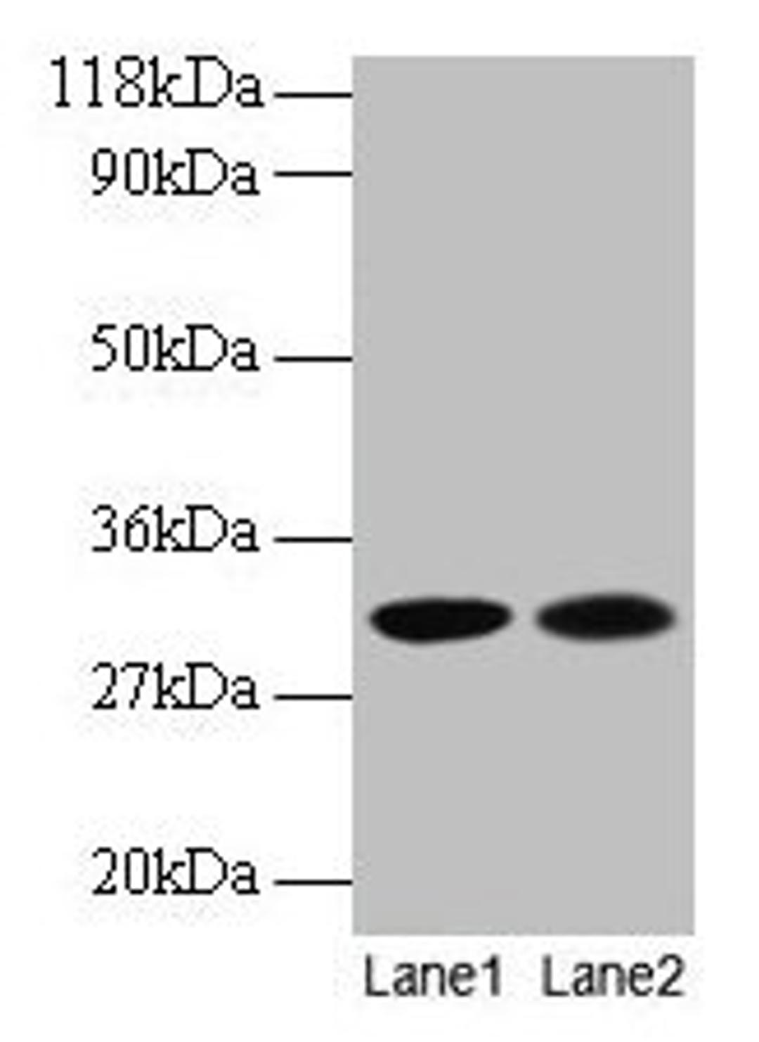 Western blot. All lanes: MRPL9 antibody at 2µg/ml. Lane 1: EC109 whole cell lysate. Lane 2: 293T whole cell lysate. Secondary. Goat polyclonal to rabbit IgG at 1/15000 dilution. Predicted band size: 31 kDa. Observed band size: 31 kDa