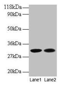 Western blot. All lanes: MRPL9 antibody at 2µg/ml. Lane 1: EC109 whole cell lysate. Lane 2: 293T whole cell lysate. Secondary. Goat polyclonal to rabbit IgG at 1/15000 dilution. Predicted band size: 31 kDa. Observed band size: 31 kDa