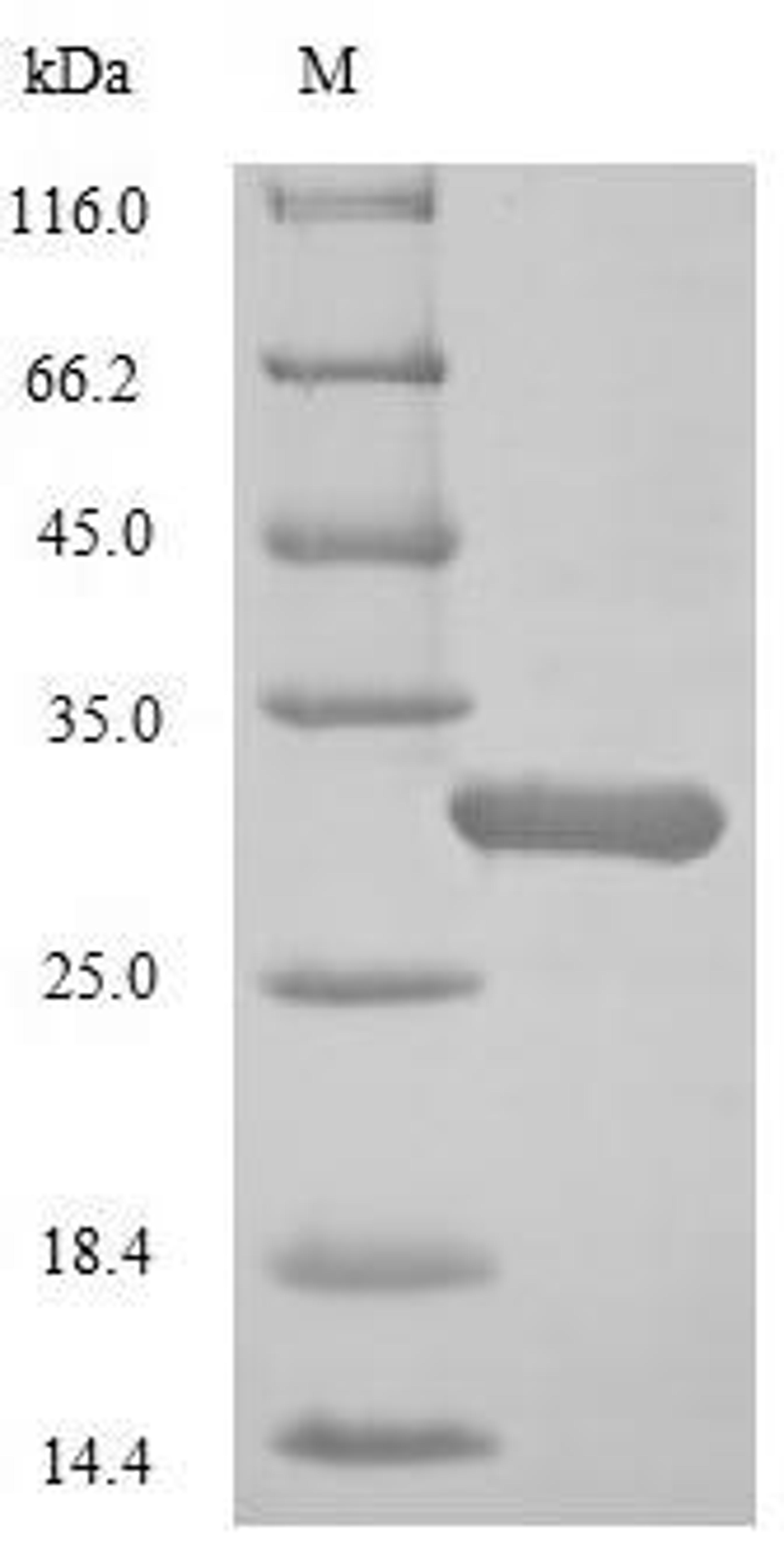 (Tris-Glycine gel) Discontinuous SDS-PAGE (reduced) with 5% enrichment gel and 15% separation gel.