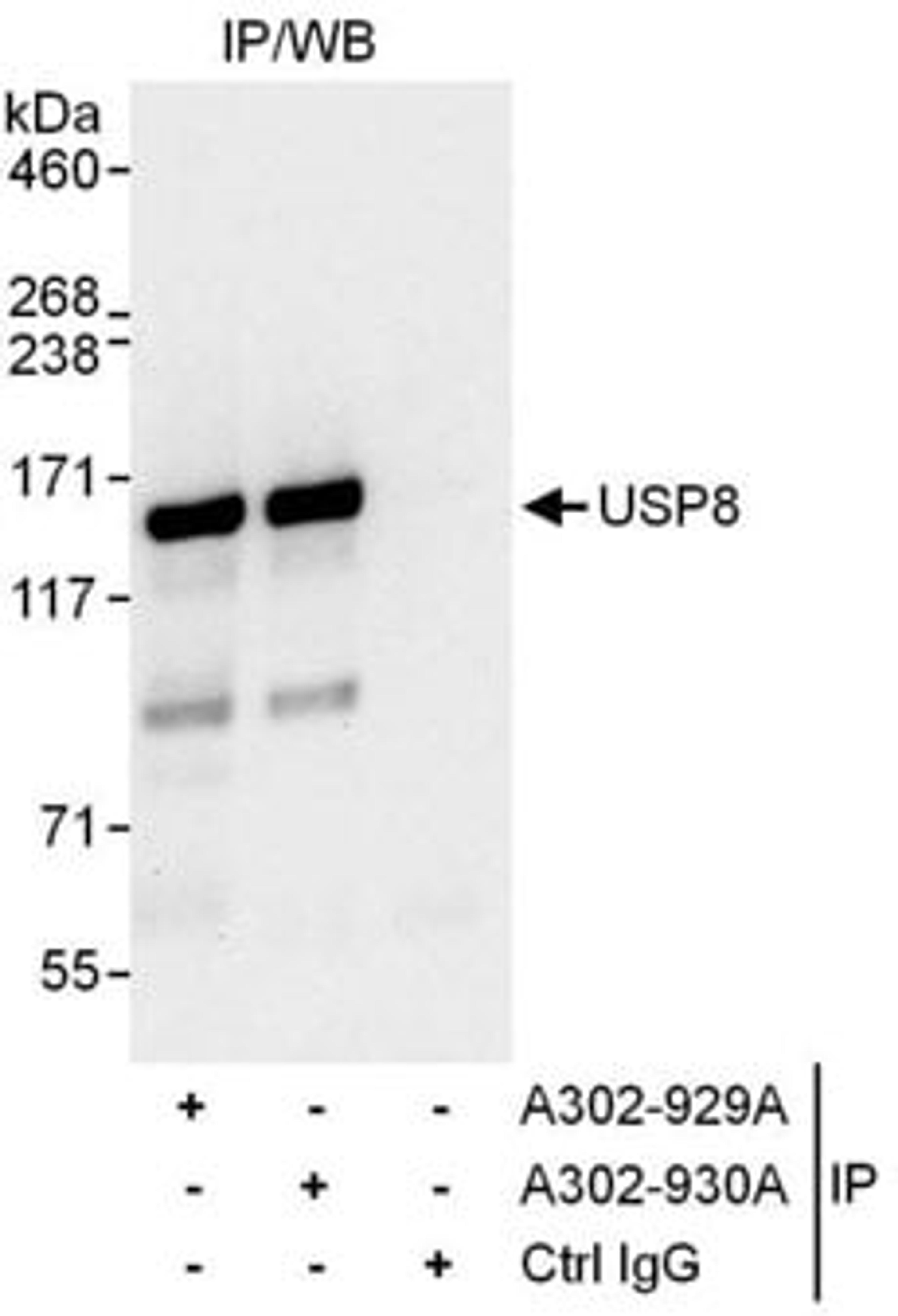 Detection of human USP8 by western blot of immunoprecipitates.