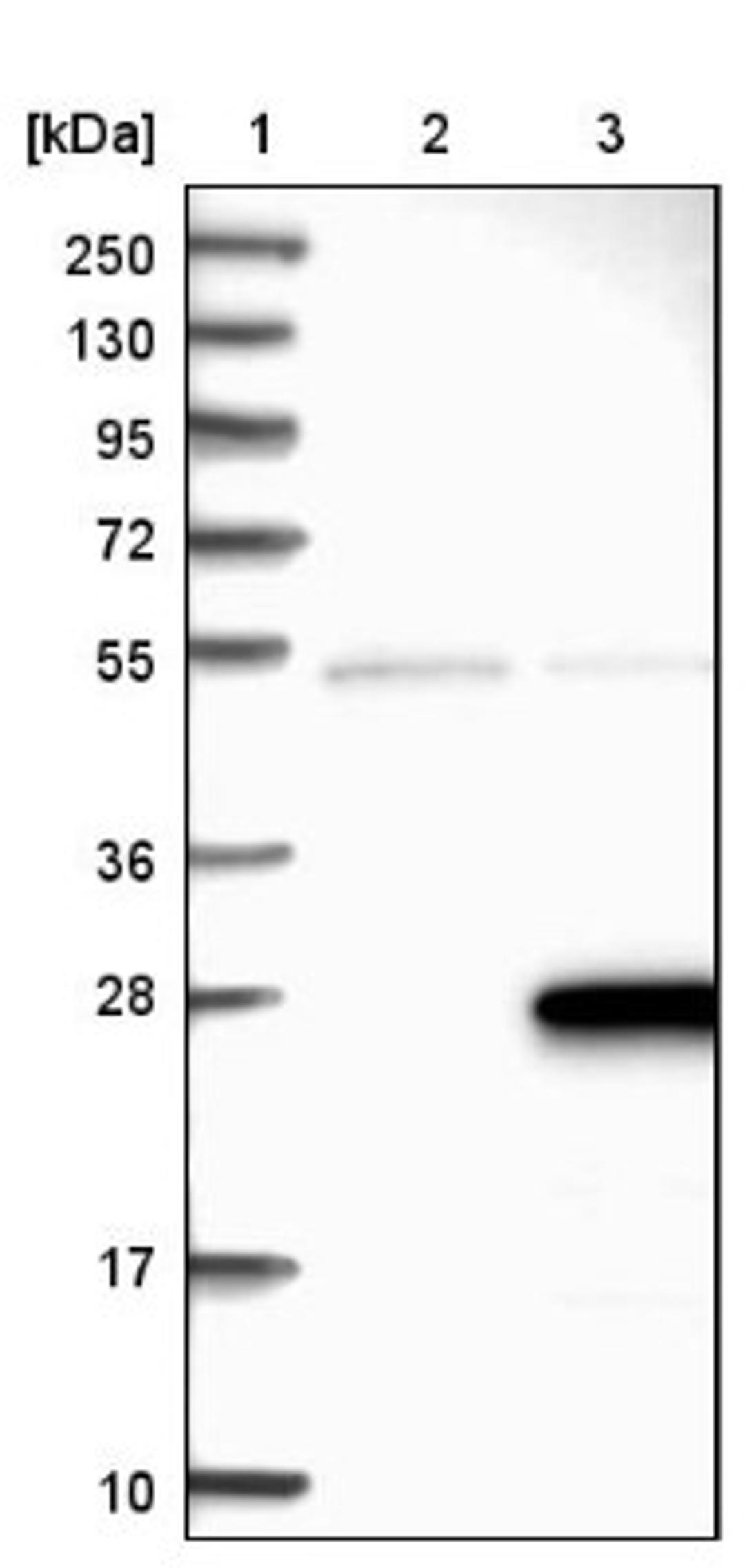 Western Blot: ZMAT5 Antibody [NBP1-85794] - Lane 1: Marker [kDa] 250, 130, 95, 72, 55, 36, 28, 17, 10<br/>Lane 2: Negative control (vector only transfected HEK293T lysate)<br/>Lane 3: Over-expression lysate (Co-expressed with a C-terminal myc-DDK tag (~3.1 kDa) in mammalian HEK293T cells, LY412745)