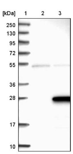 Western Blot: ZMAT5 Antibody [NBP1-85794] - Lane 1: Marker [kDa] 250, 130, 95, 72, 55, 36, 28, 17, 10<br/>Lane 2: Negative control (vector only transfected HEK293T lysate)<br/>Lane 3: Over-expression lysate (Co-expressed with a C-terminal myc-DDK tag (~3.1 kDa) in mammalian HEK293T cells, LY412745)