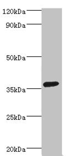 Western blot. All lanes: PDZ and LIM domain protein 1 antibody at 2ug/ml + HepG2 whole cell lysate. Secondary. Goat polyclonal to rabbit IgG at 1/10000 dilution. Predicted band size: 36 kDa. Observed band size: 36 kDa.